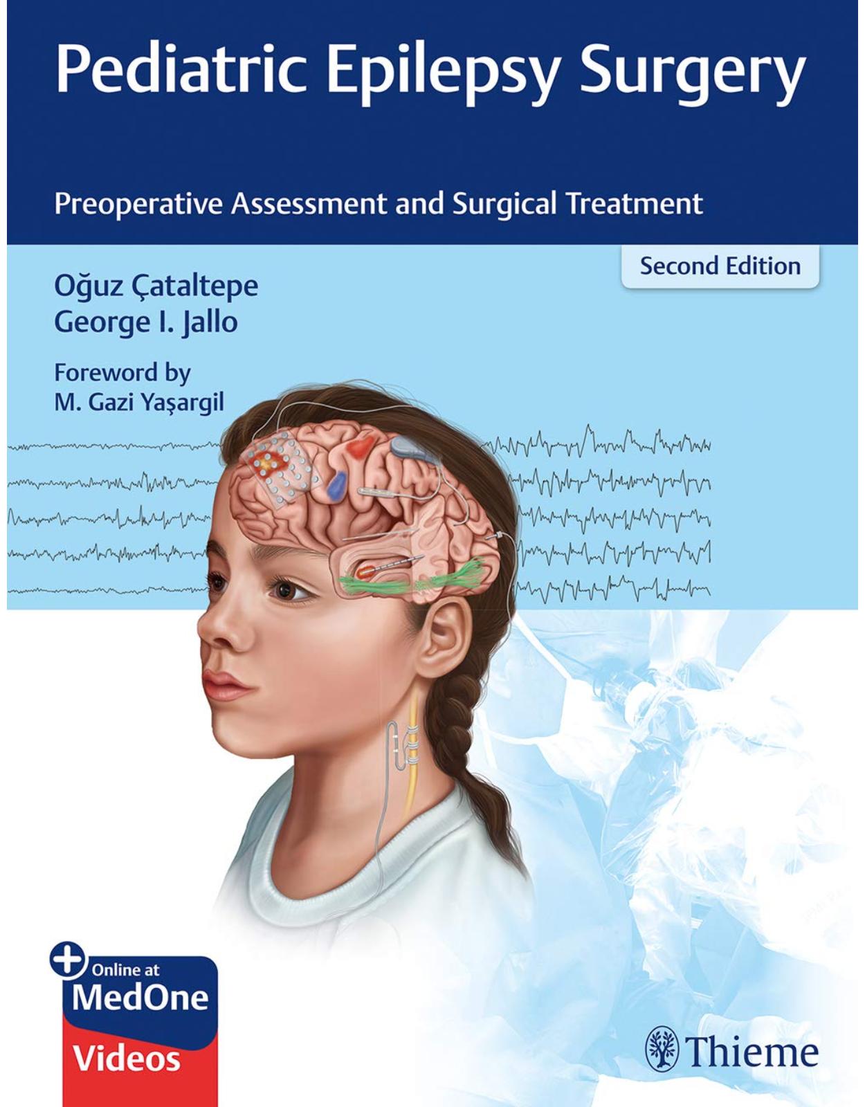 Pediatric Epilepsy Surgery: Preoperative Assessment and Surgical Treatment