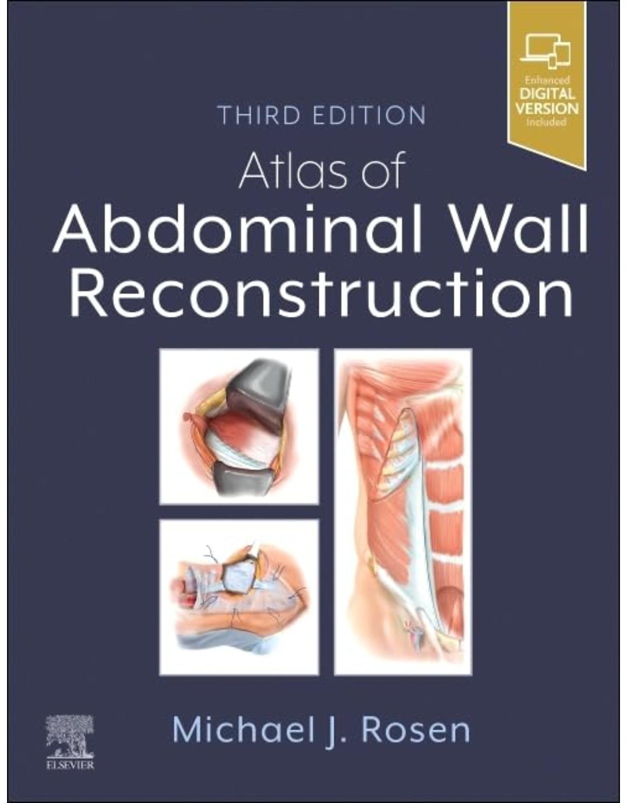 Atlas of Abdominal Wall Reconstruction 3rd Edition