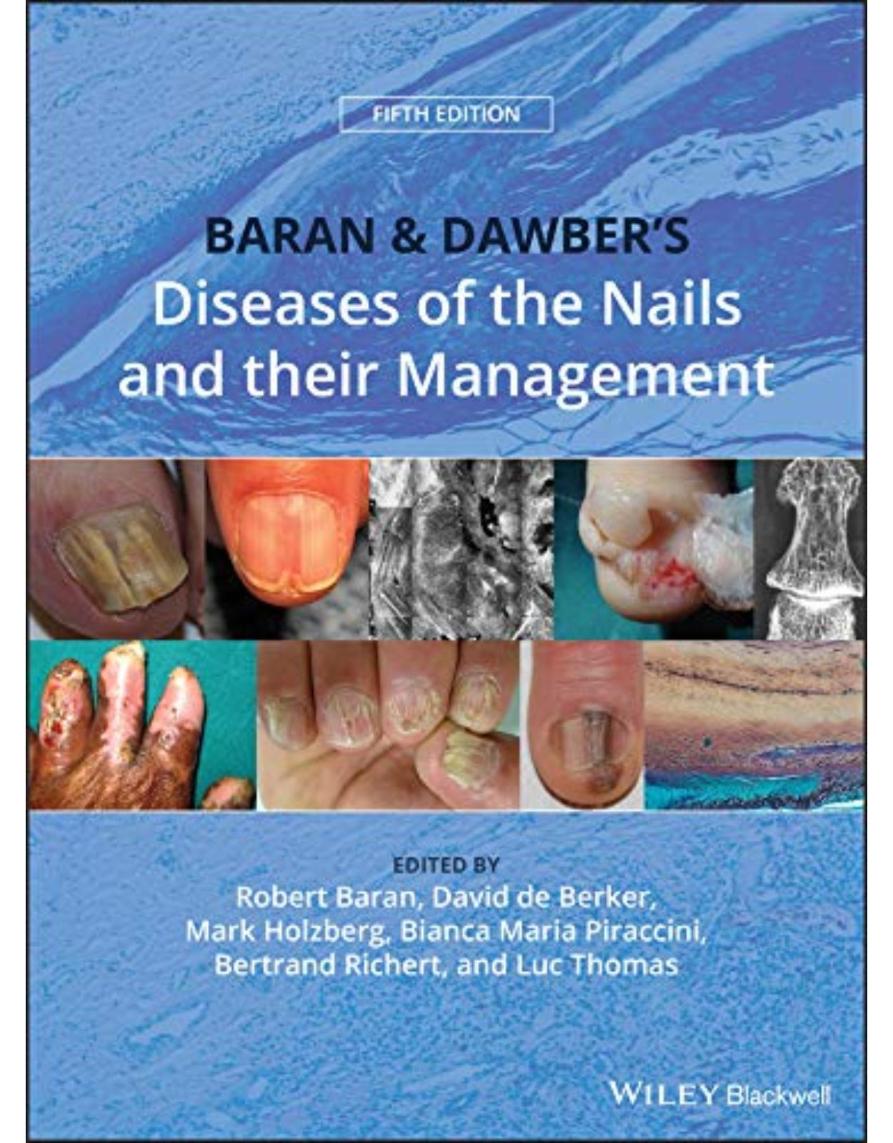 Baran and Dawber’s Diseases of the Nails and their Management, 5th Edition