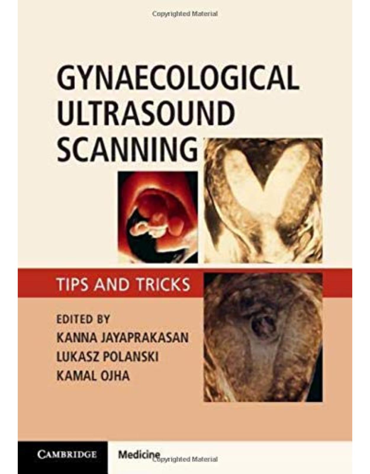 Gynaecological Ultrasound Scanning: Tips and Tricks