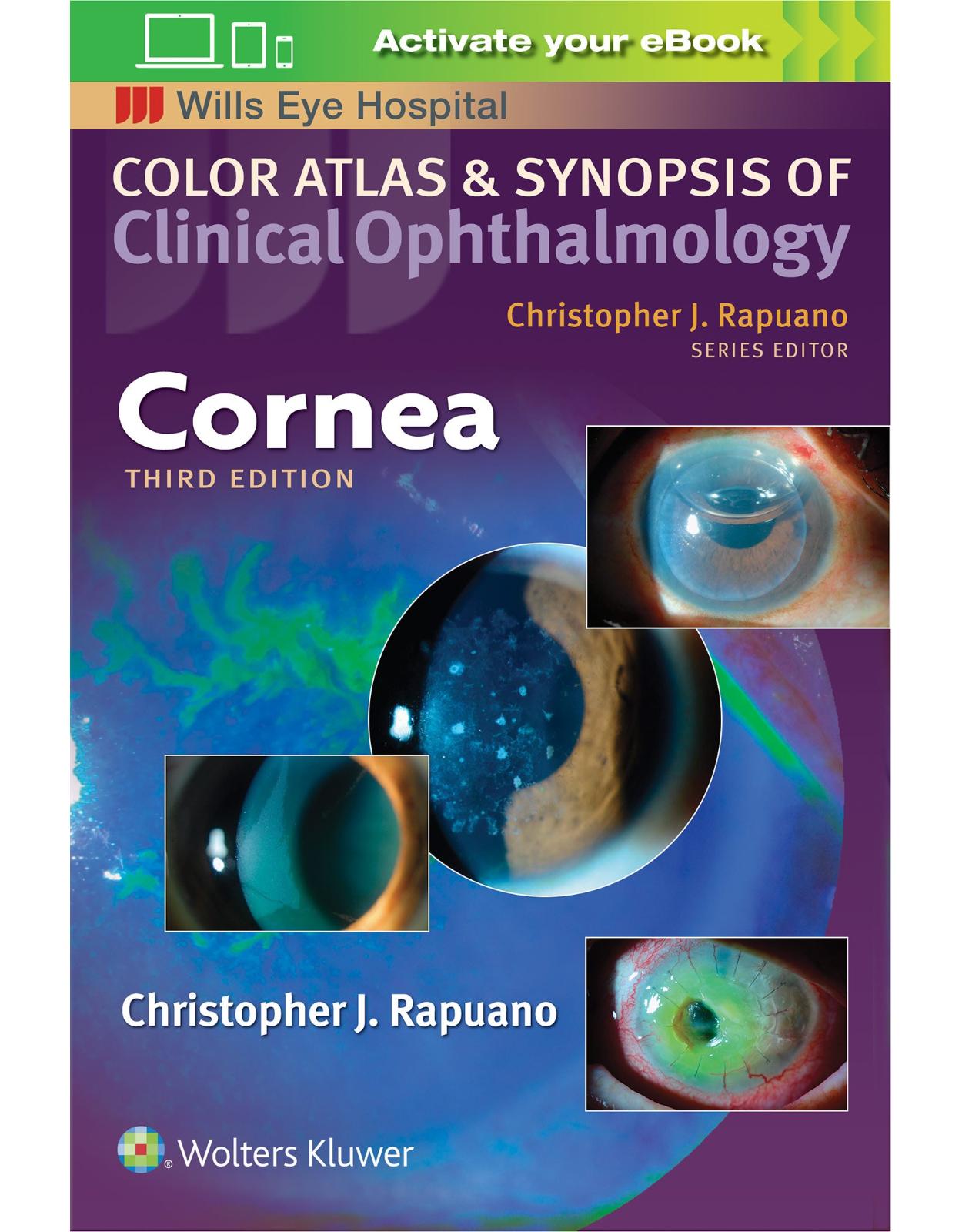 Cornea (Color Atlas & Synopsis of Clinical Ophthalmology) 