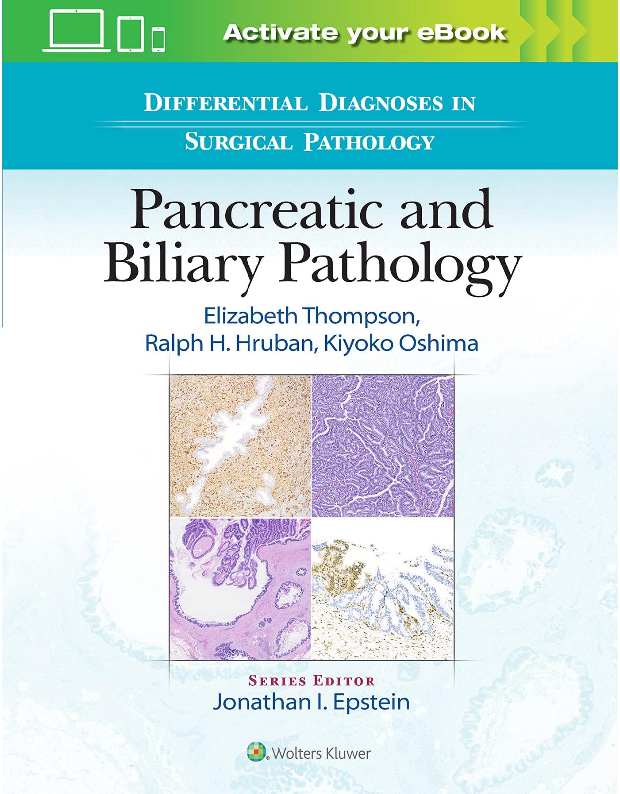 Differential Diagnoses in Surgical Pathology: Pancreatic and Biliary Pathology 