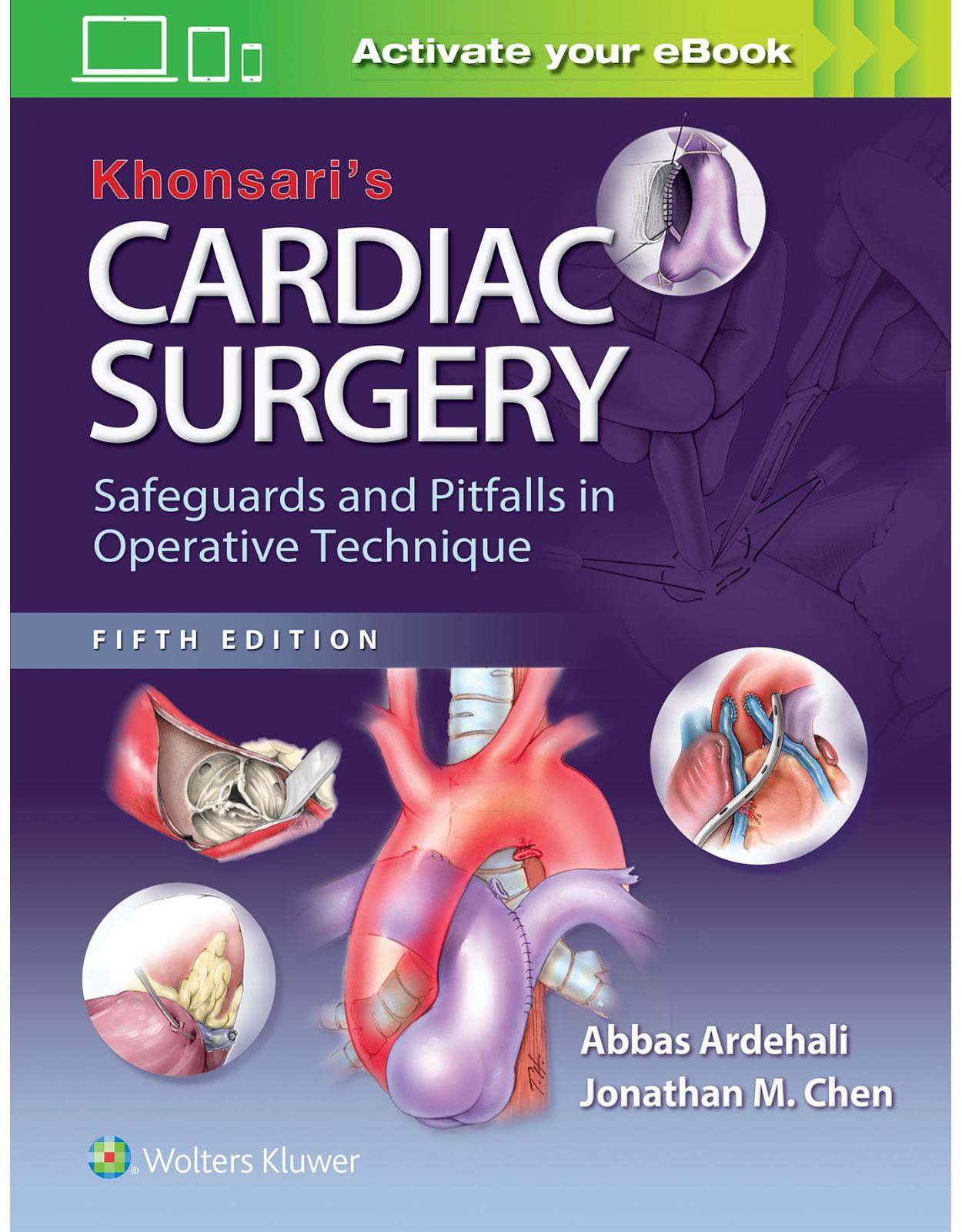Khonsari's Cardiac Surgery: Safeguards and Pitfalls in Operative Technique 