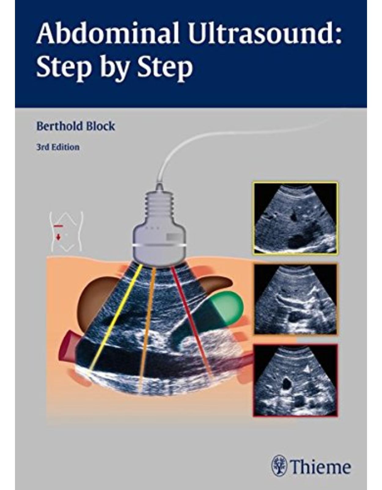 Abdominal Ultrasound: Step by Step