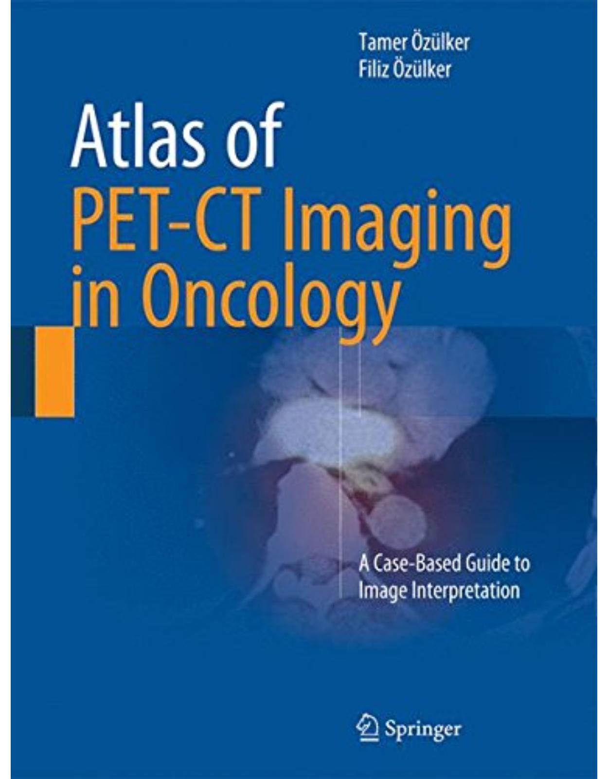 Atlas of PET-CT Imaging in Oncology