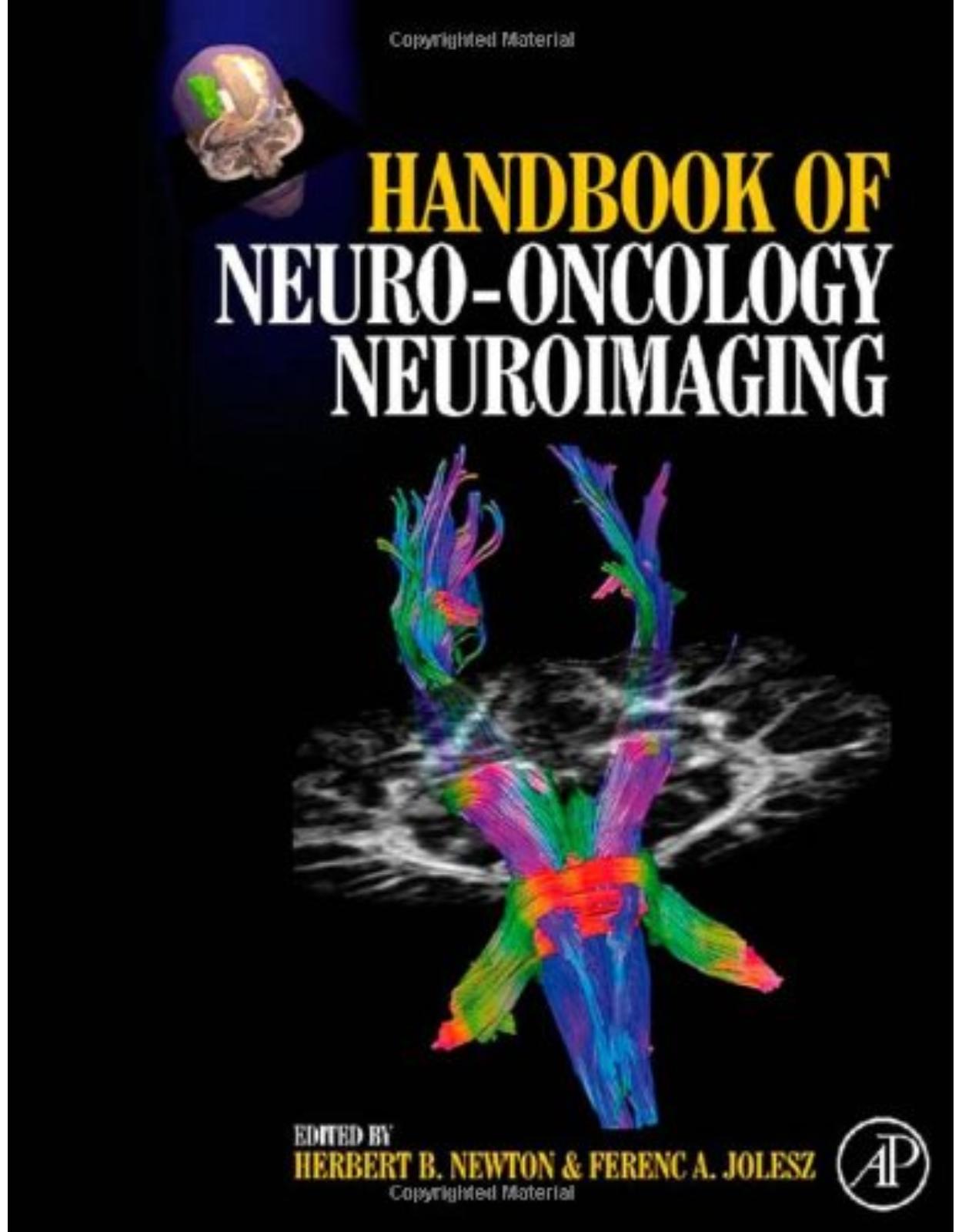 Handbook of Neuro-Oncology Neuroimaging