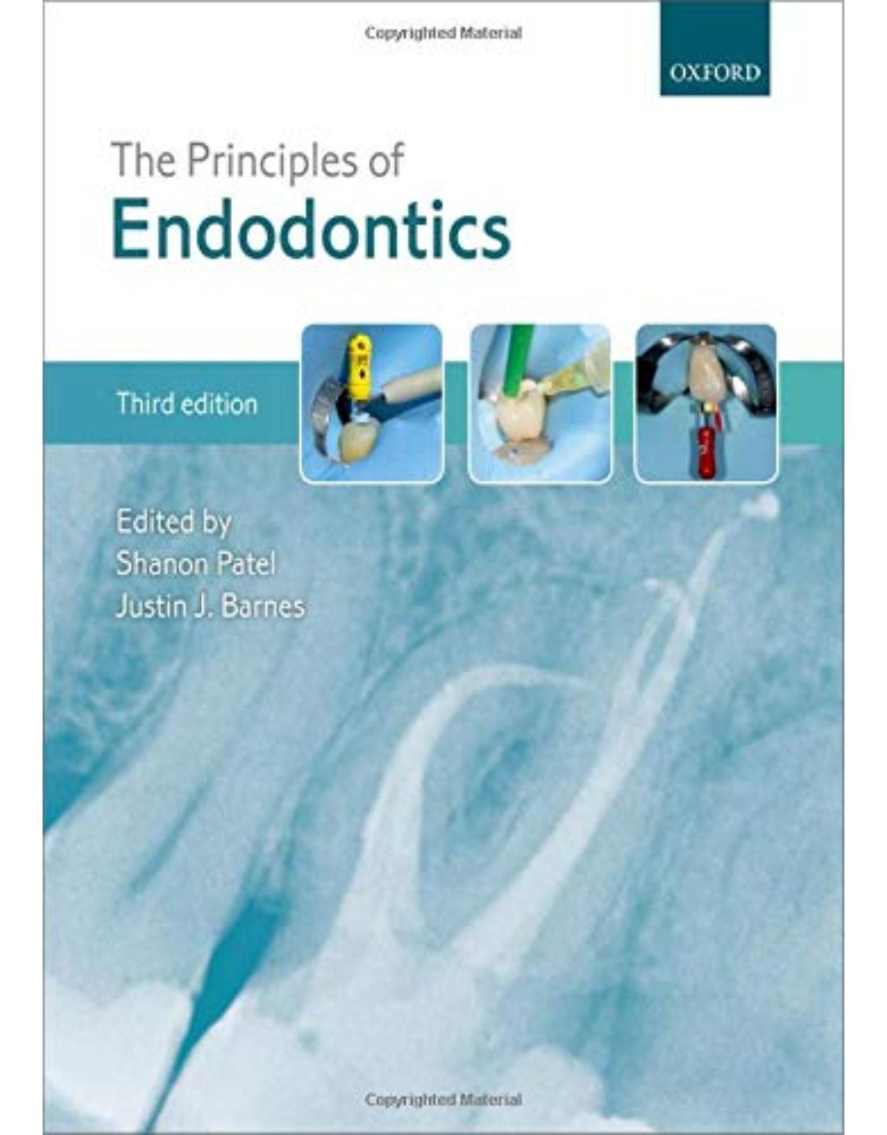 The Principles of Endodontics