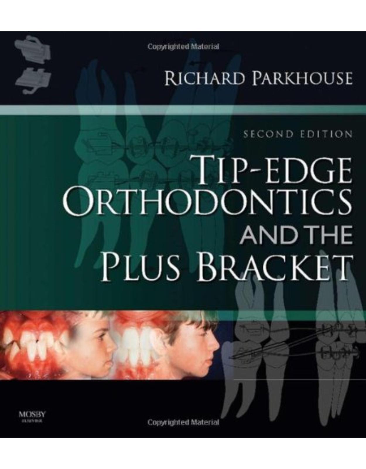Tip-Edge Orthodontics and the Plus Bracket