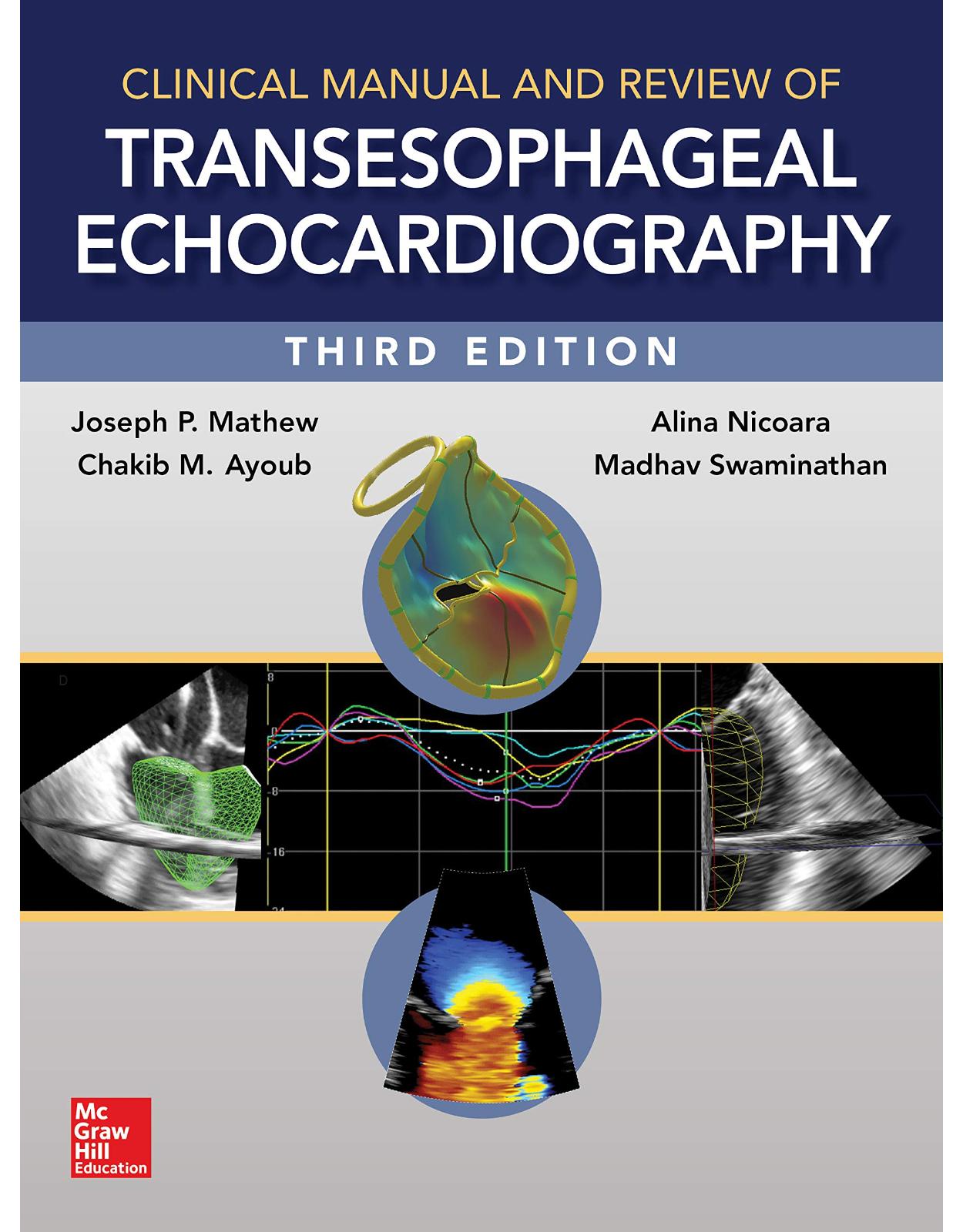 Clinical Manual and Review of Transesophageal Echocardiography