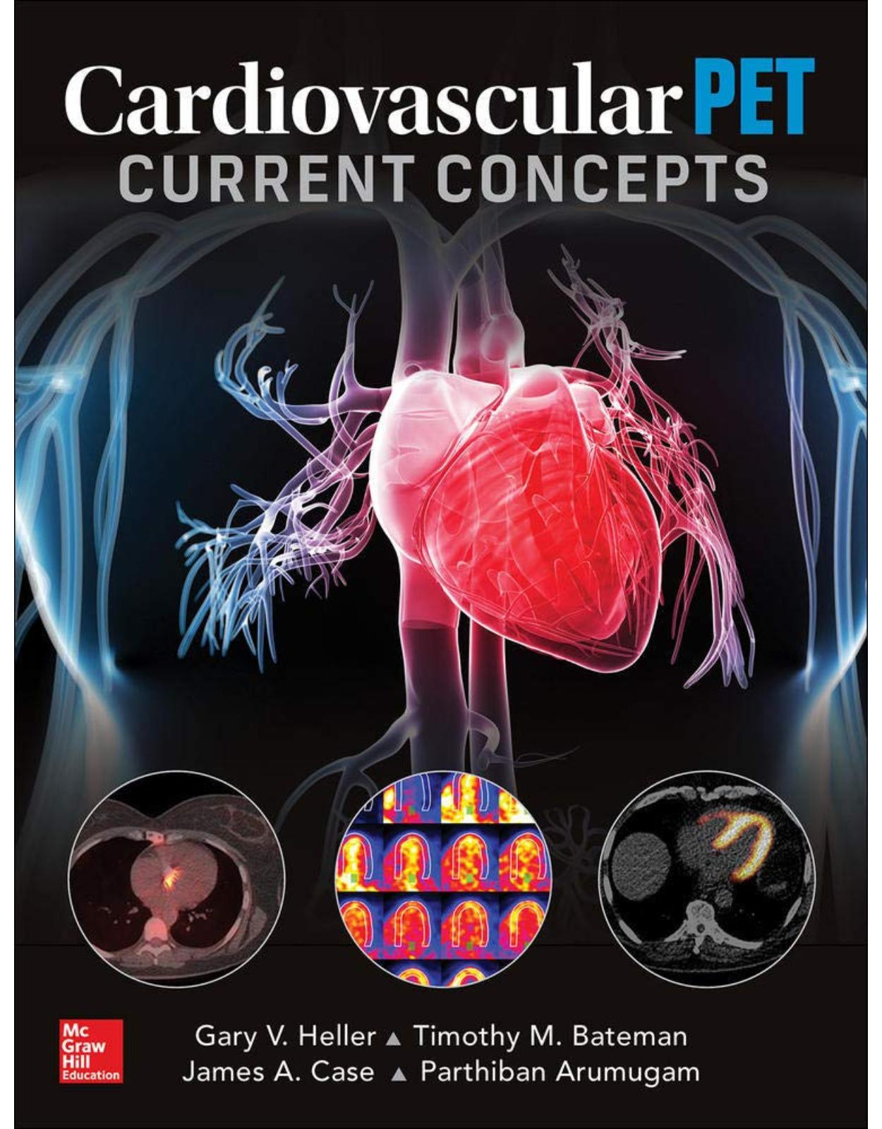 Cardiovascular PET: Current Concepts