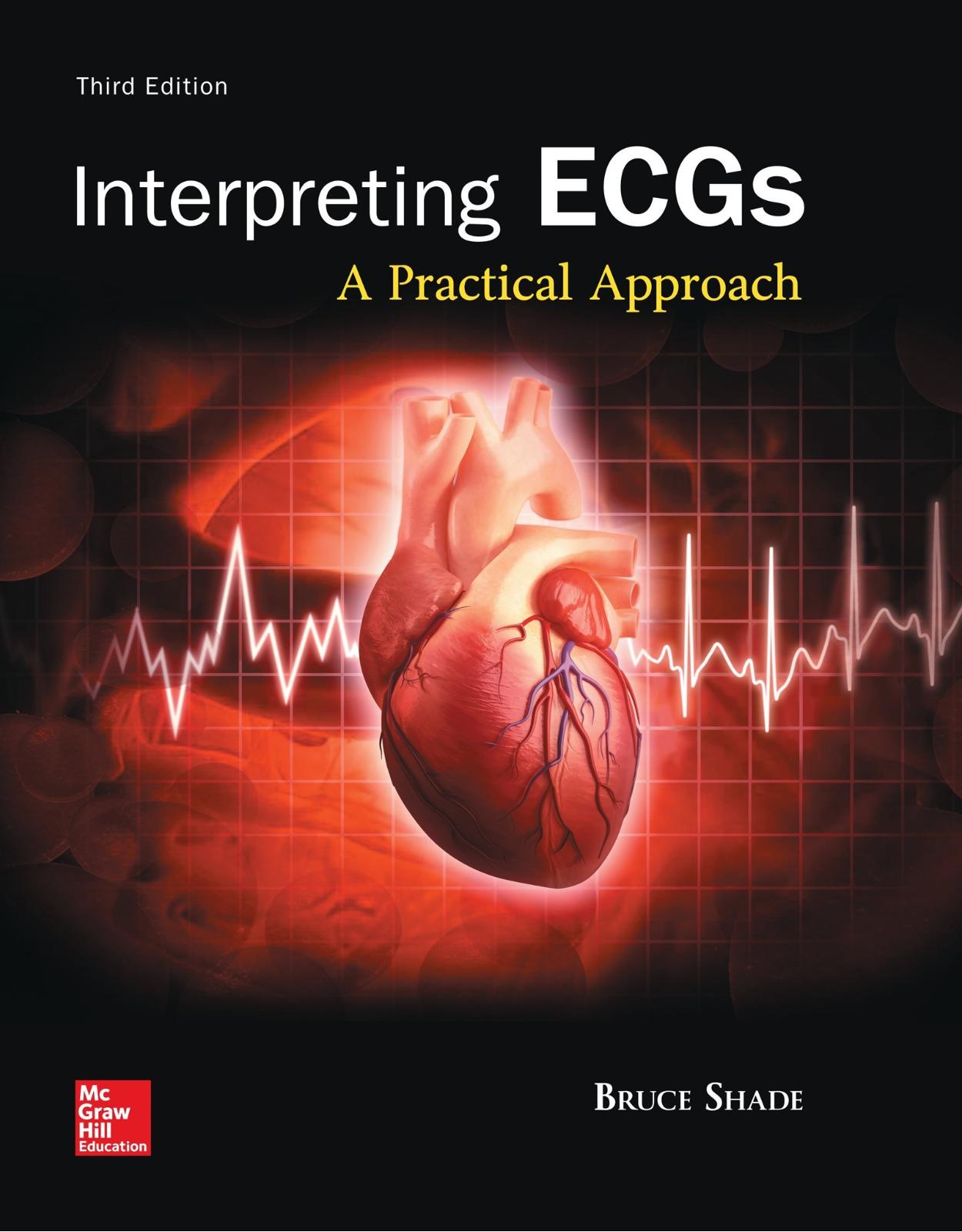 Interpreting ECGs: A Practical Approach