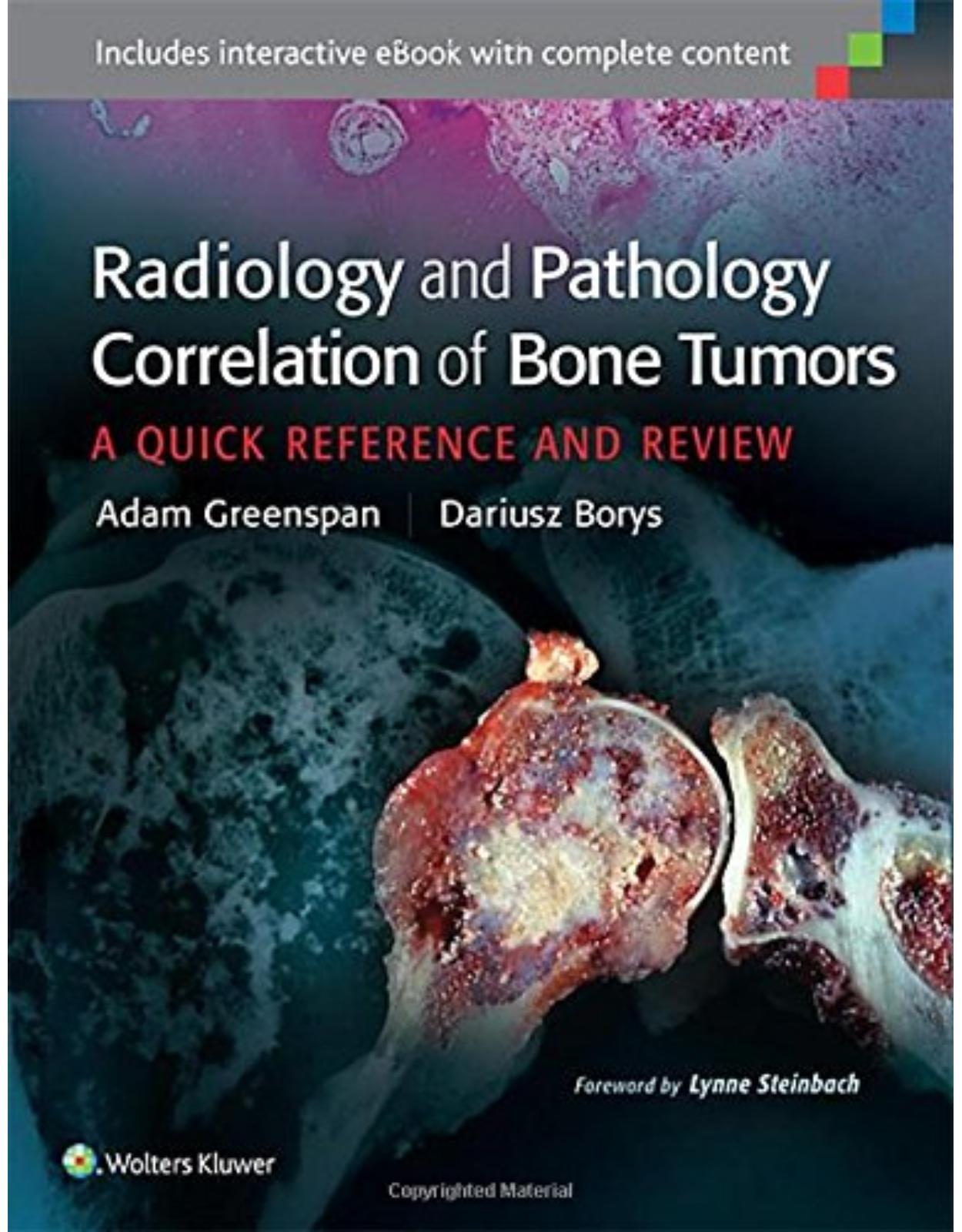 Radiology and Pathology Correlation of Bone Tumors