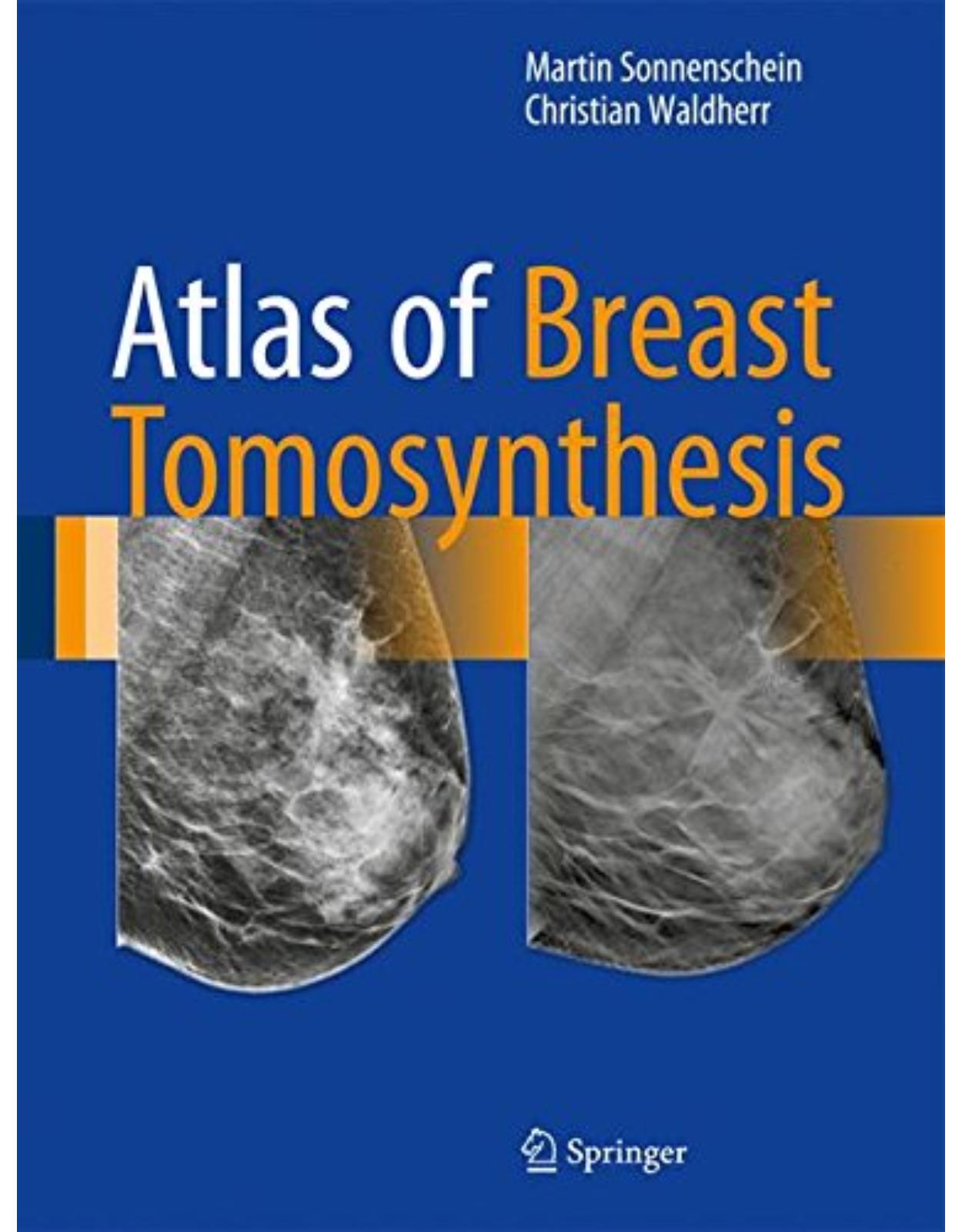 Atlas of Breast Tomosynthesis