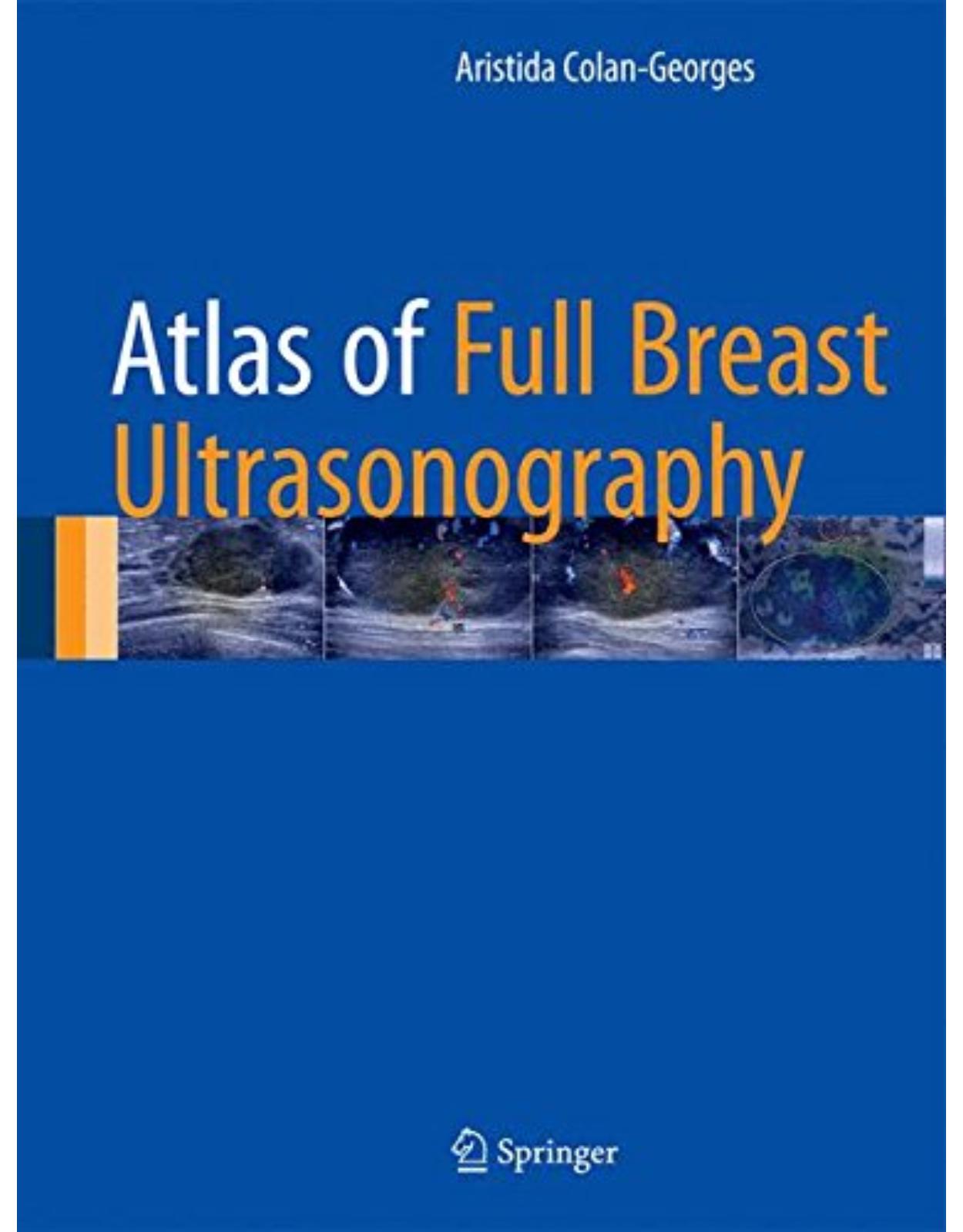 Atlas of Full Breast Ultrasonography