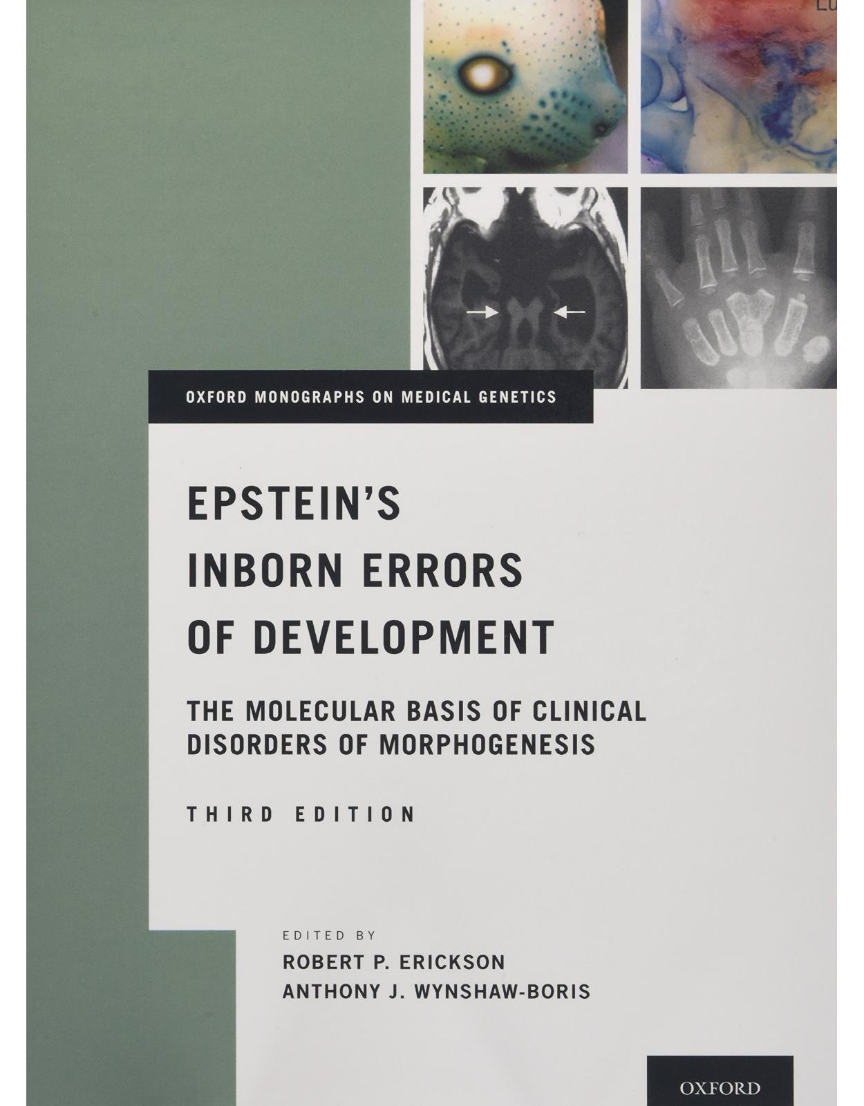 Epstein's Inborn Errors of Development: The Molecular Basis of Clinical Disorders of Morphogenesis