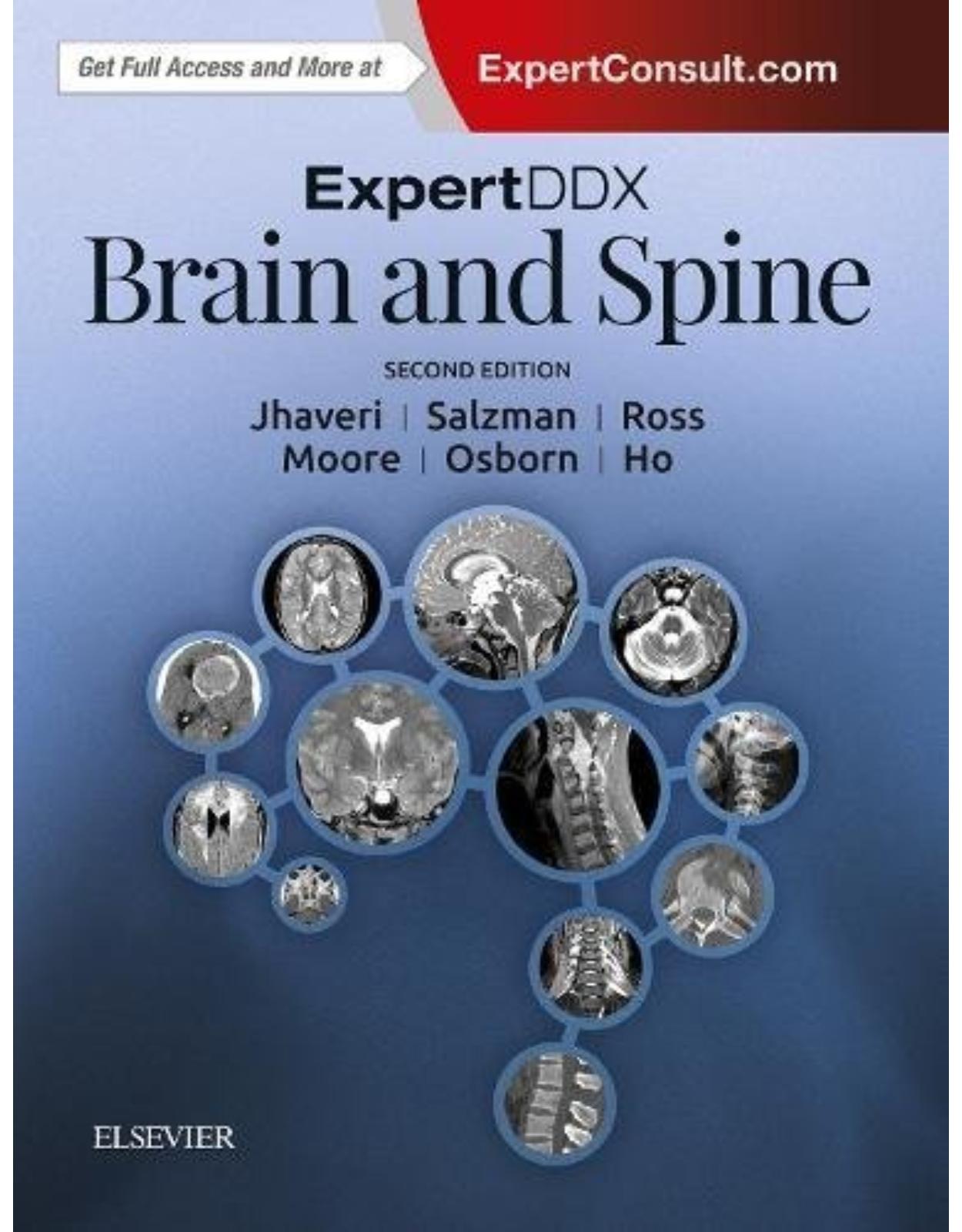 ExpertDDx: Brain and Spine, 2nd Edition