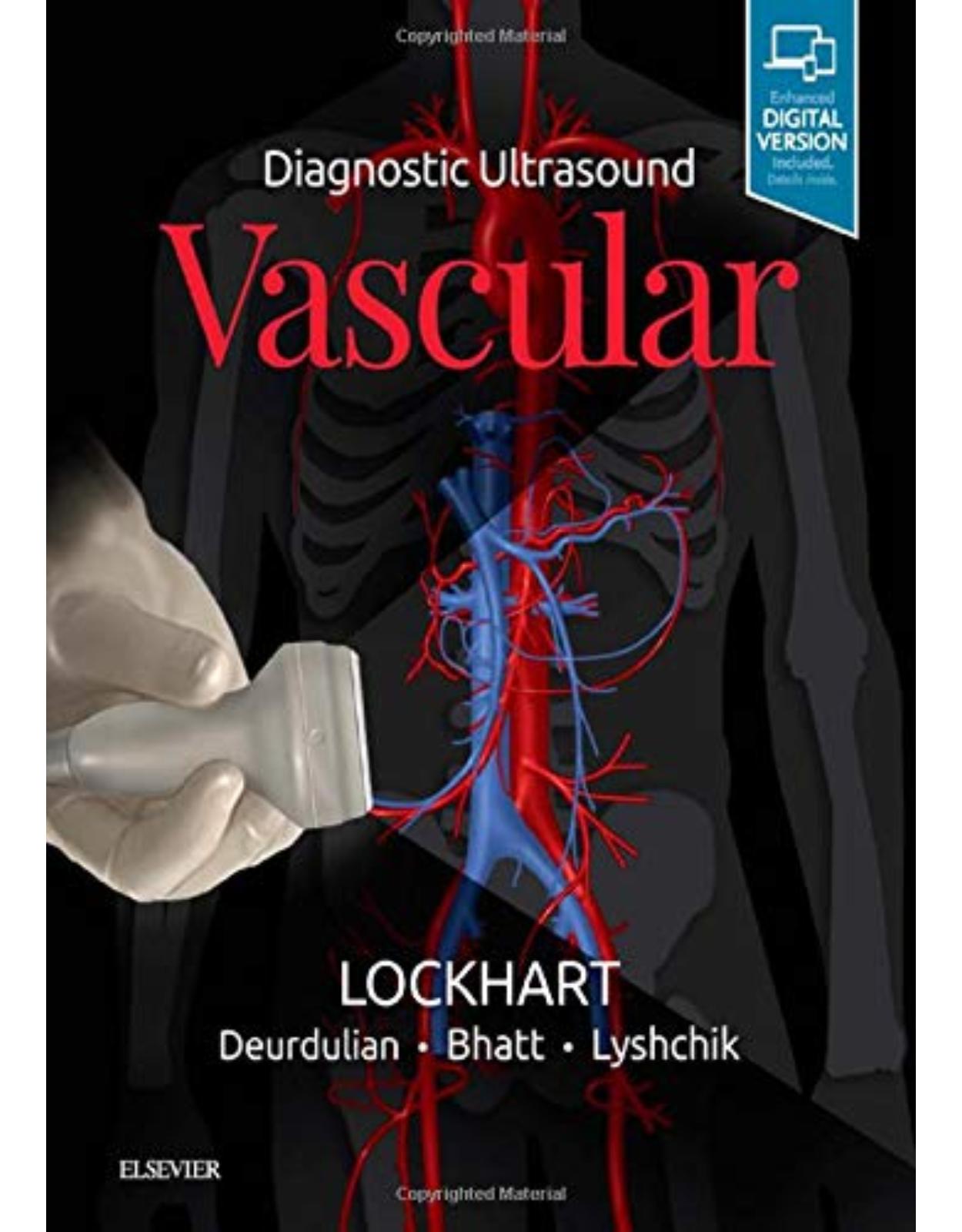 Diagnostic Ultrasound: Vascular, 1e