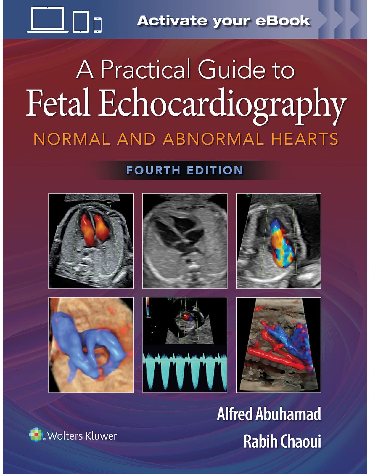 A Practical Guide to Fetal Echocardiography: Normal and Abnormal Hearts