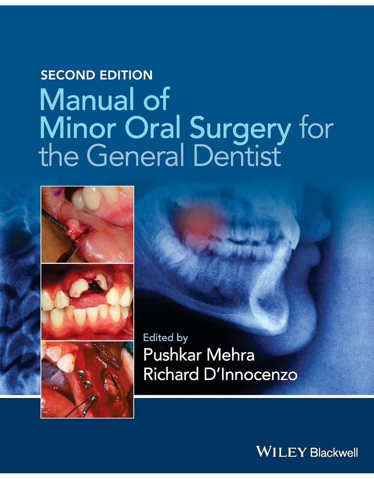 Manual of Minor Oral Surgery for the General Dentist