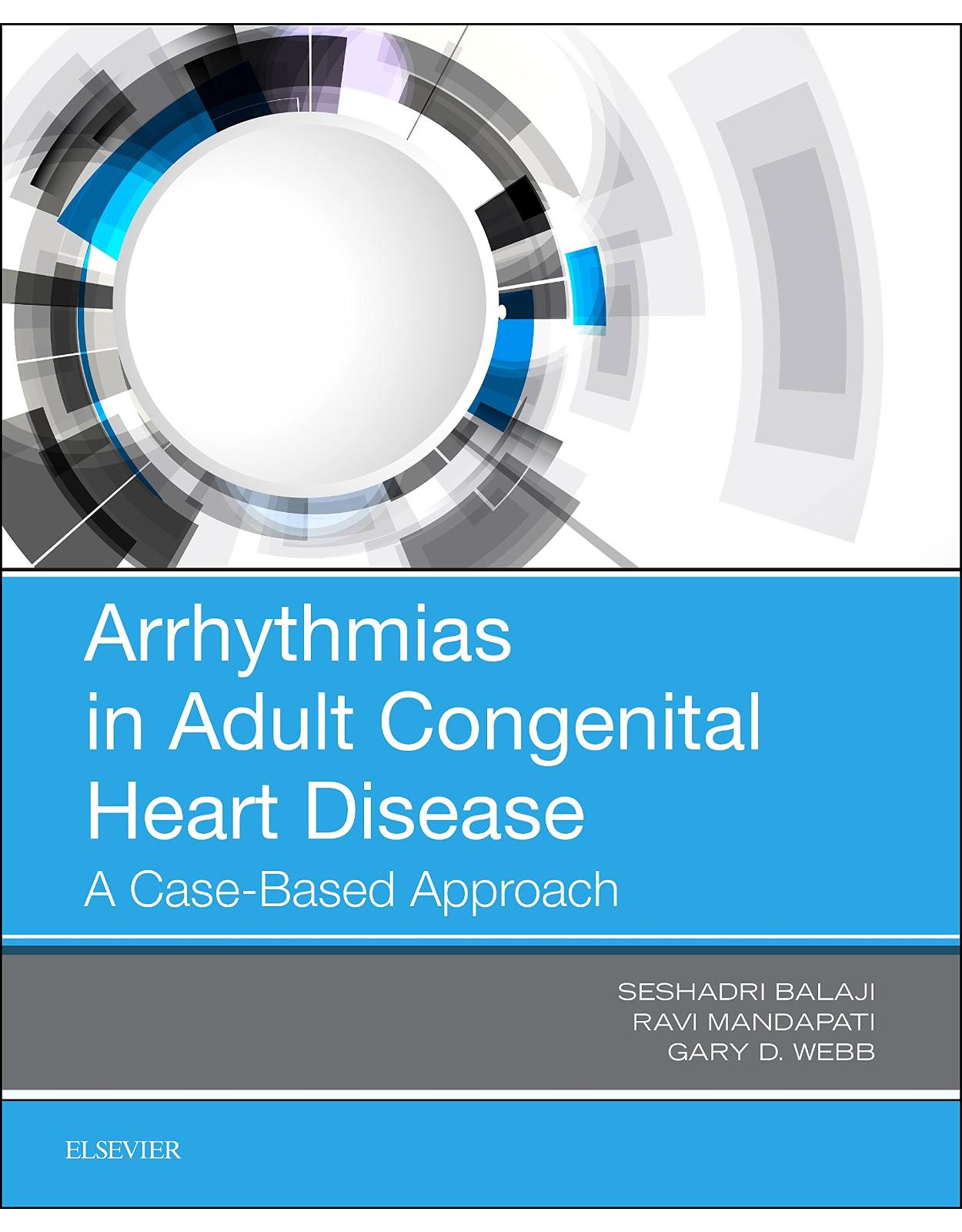 Arrhythmias in Adult Congenital Heart Disease