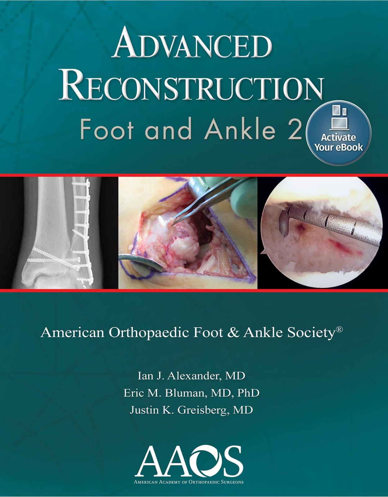 Advanced Reconstruction: Foot and Ankle 2: Print with Multimedia