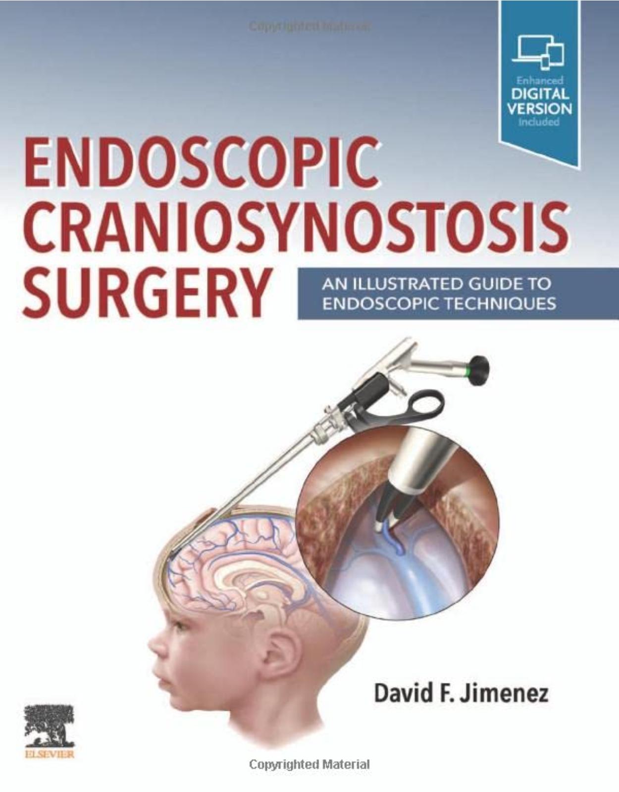 Endoscopic Craniosynostosis Surgery