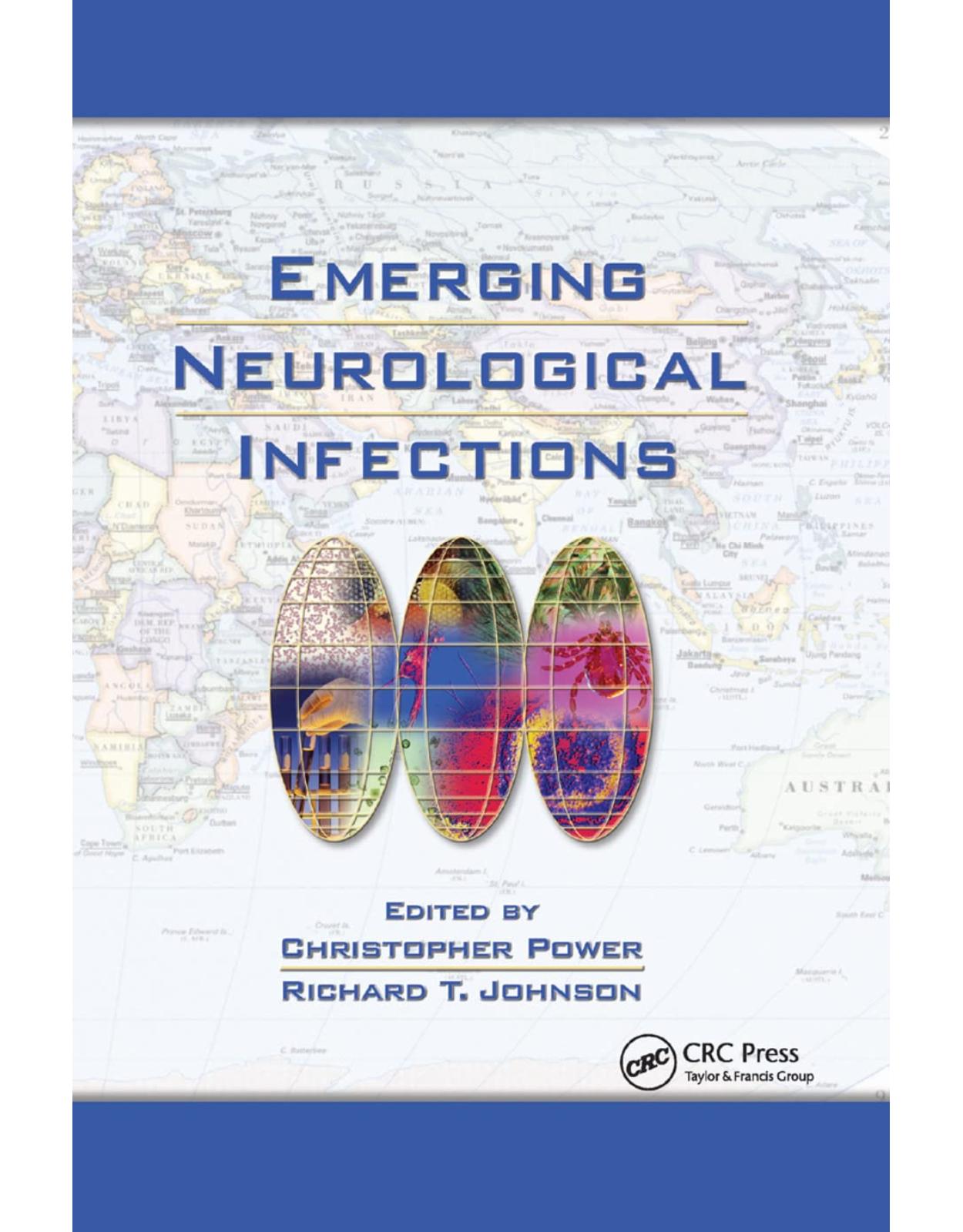 Emerging Neurological Infections