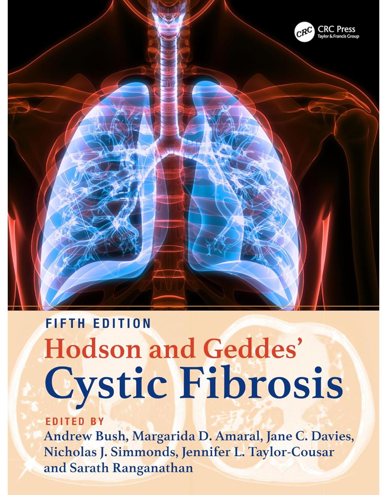 Hodson and Geddes' Cystic Fibrosis