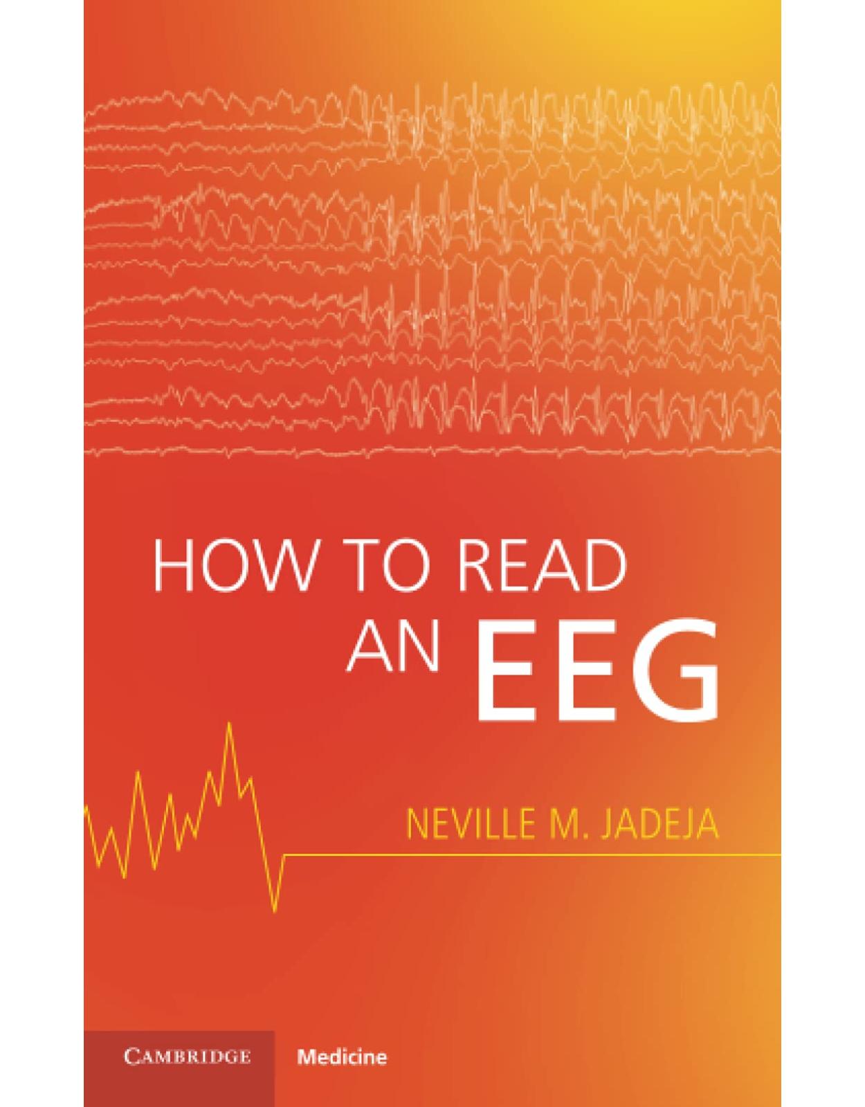 How to Read an EEG 