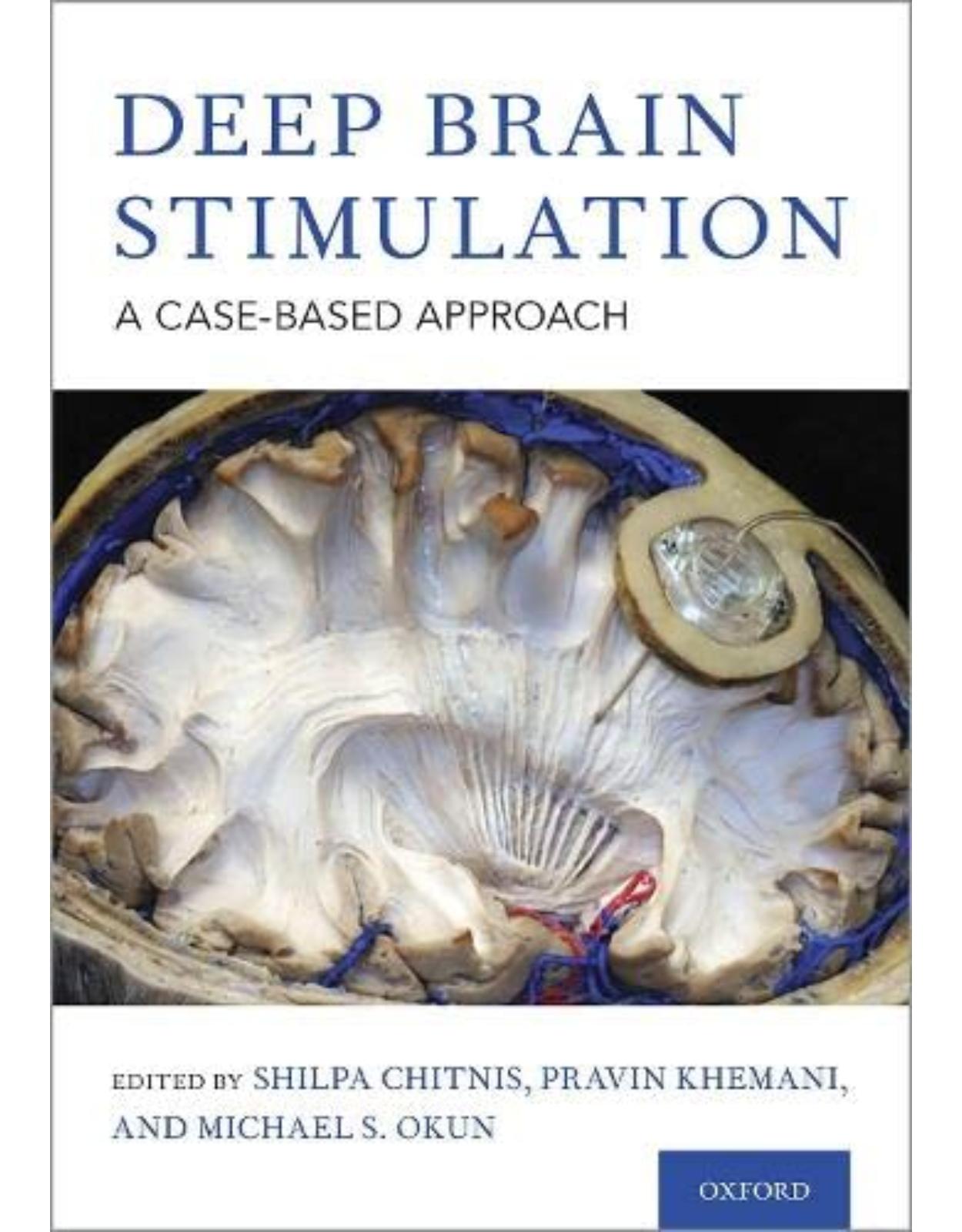 Deep Brain Stimulation: A Case-Based Approach