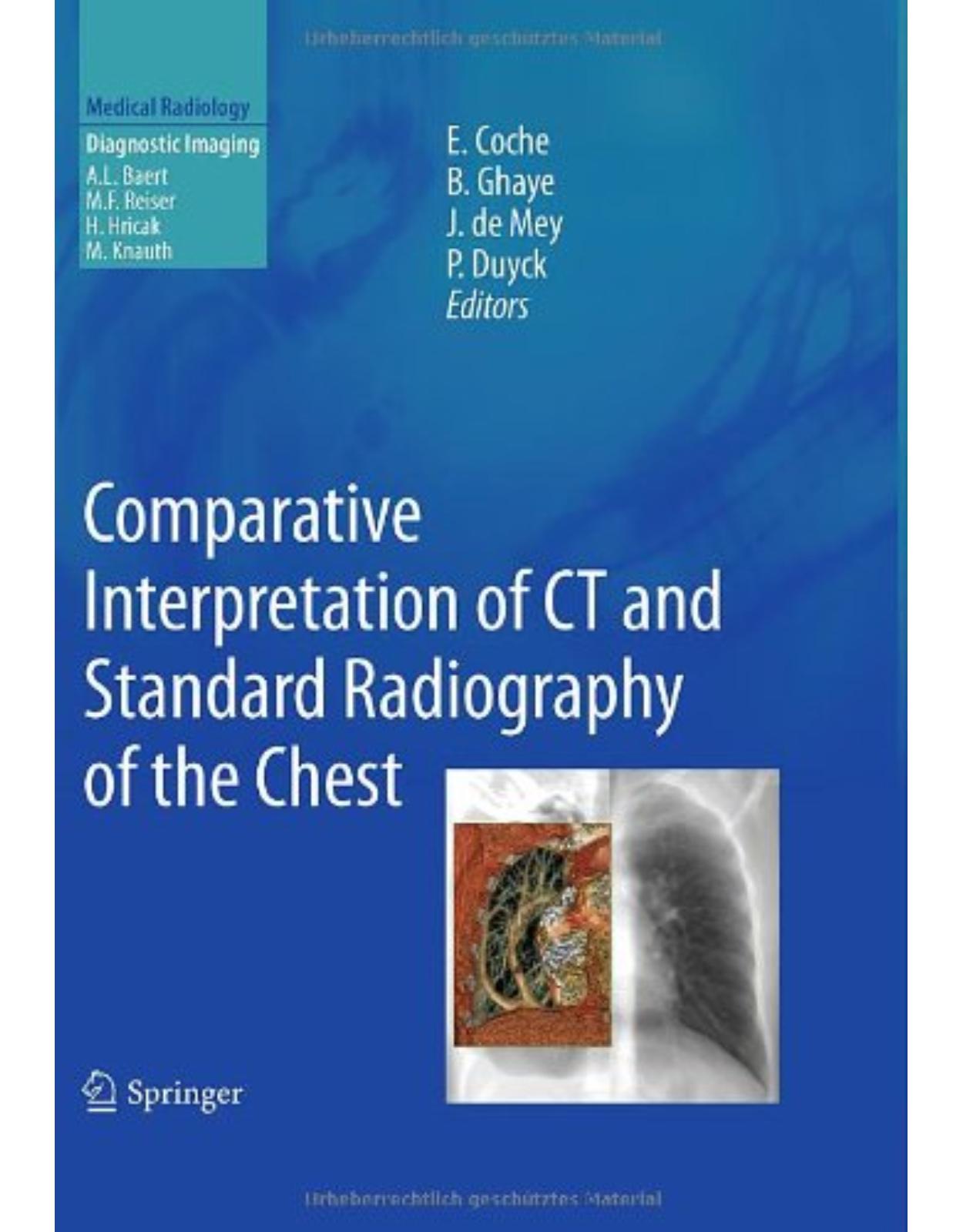 Comparative Interpretation of CT and Standard Radiography of the Chest (Medical Radiology / Diagnostic Imaging)