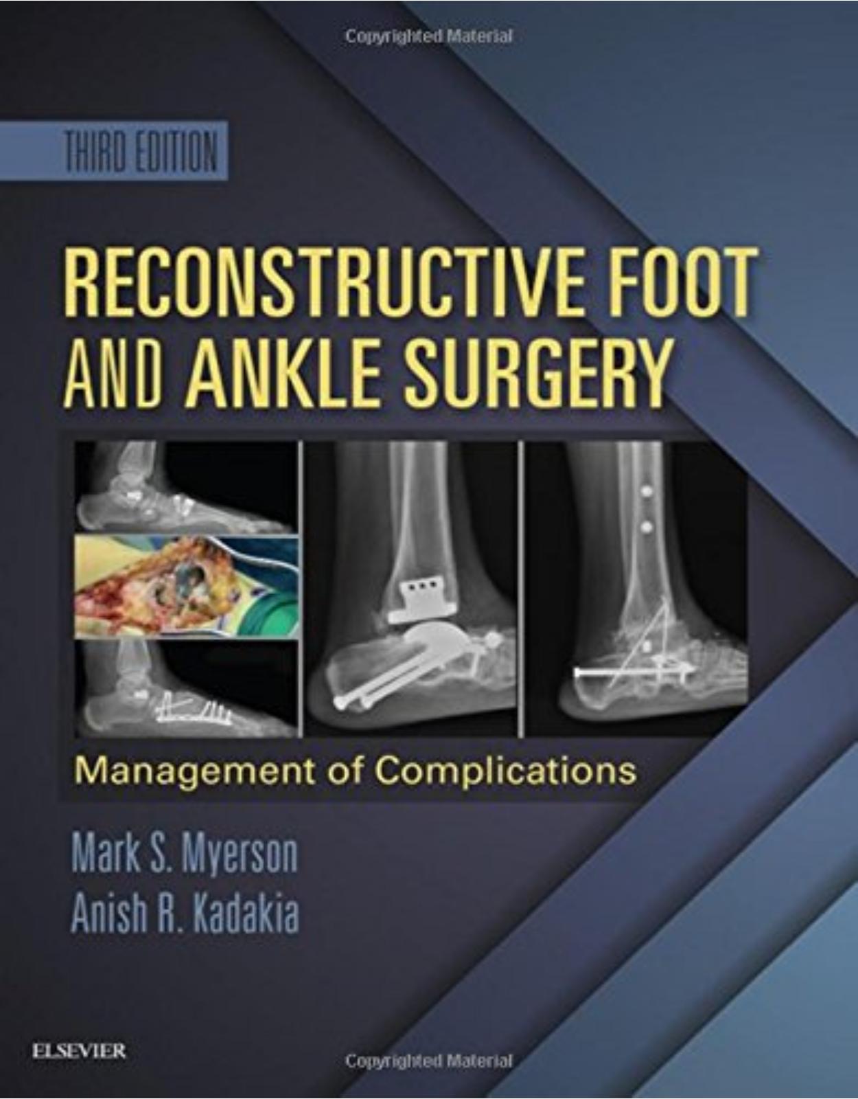 Reconstructive Foot and Ankle Surgery: Management of Complications, 3e
