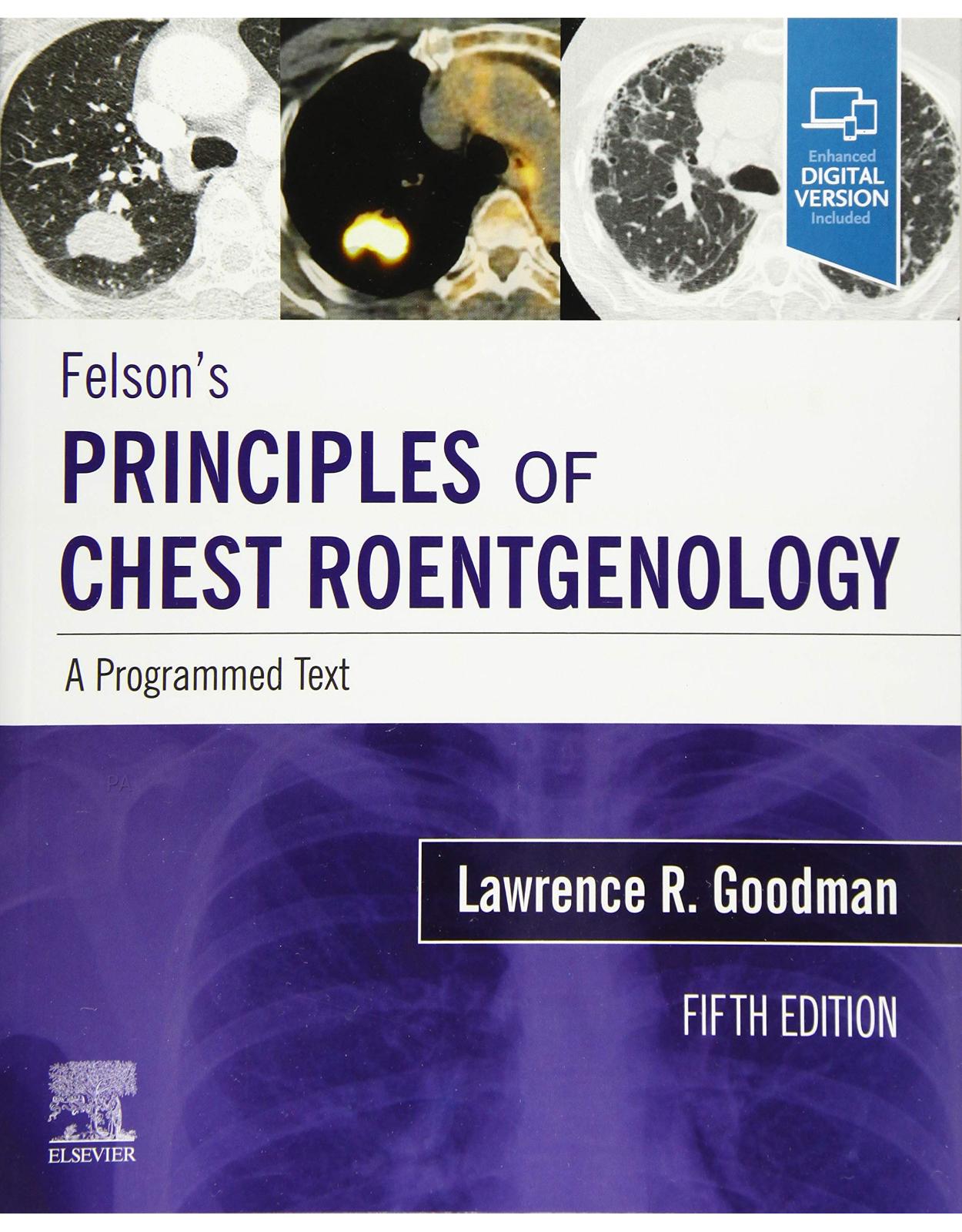 Felson's Principles of Chest Roentgenology, A Programmed Text