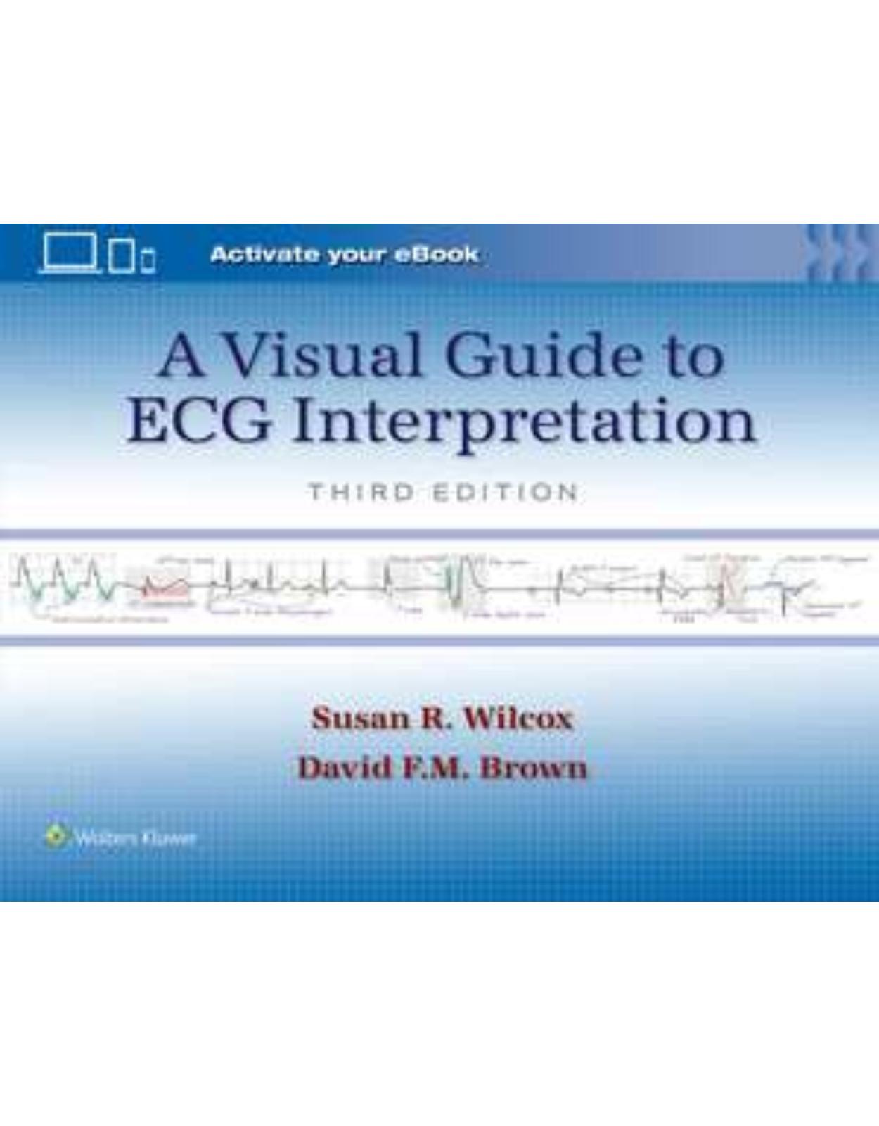 A Visual Guide to ECG Interpretation