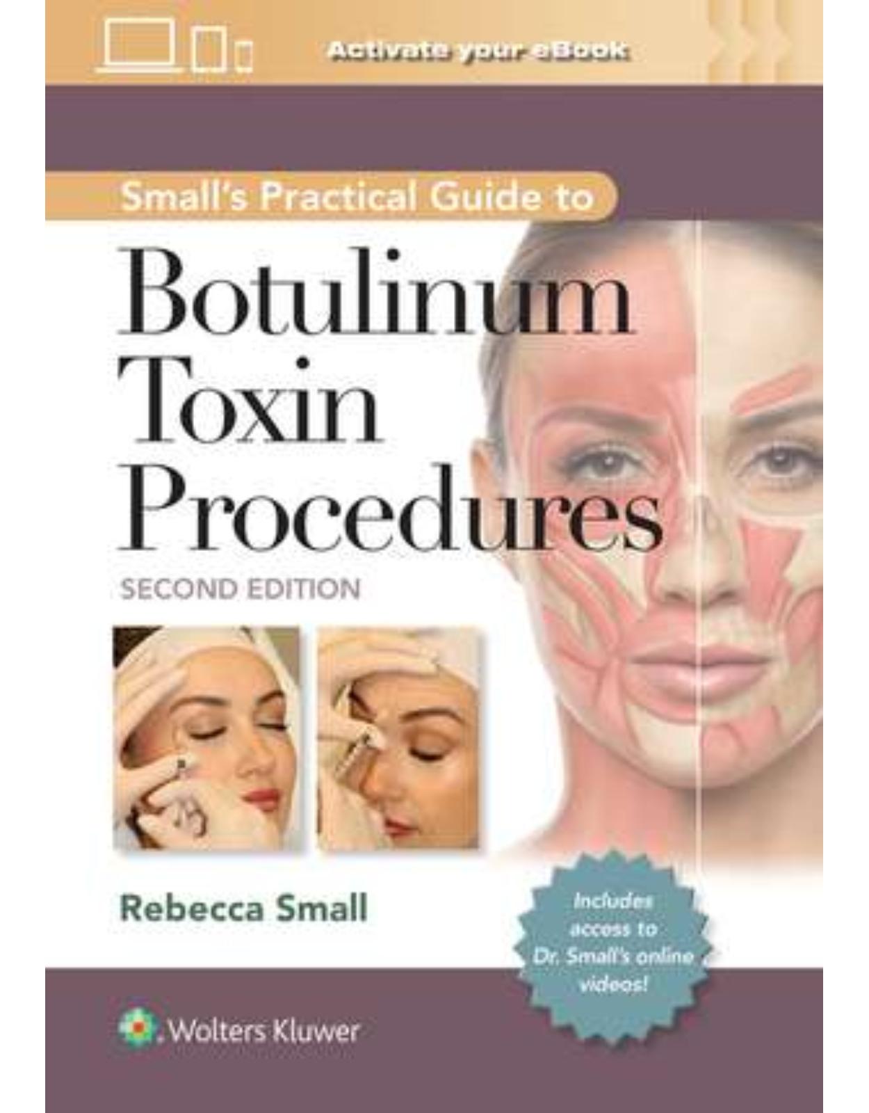 Smalls Practical Guide to Botulinum Toxin Procedures