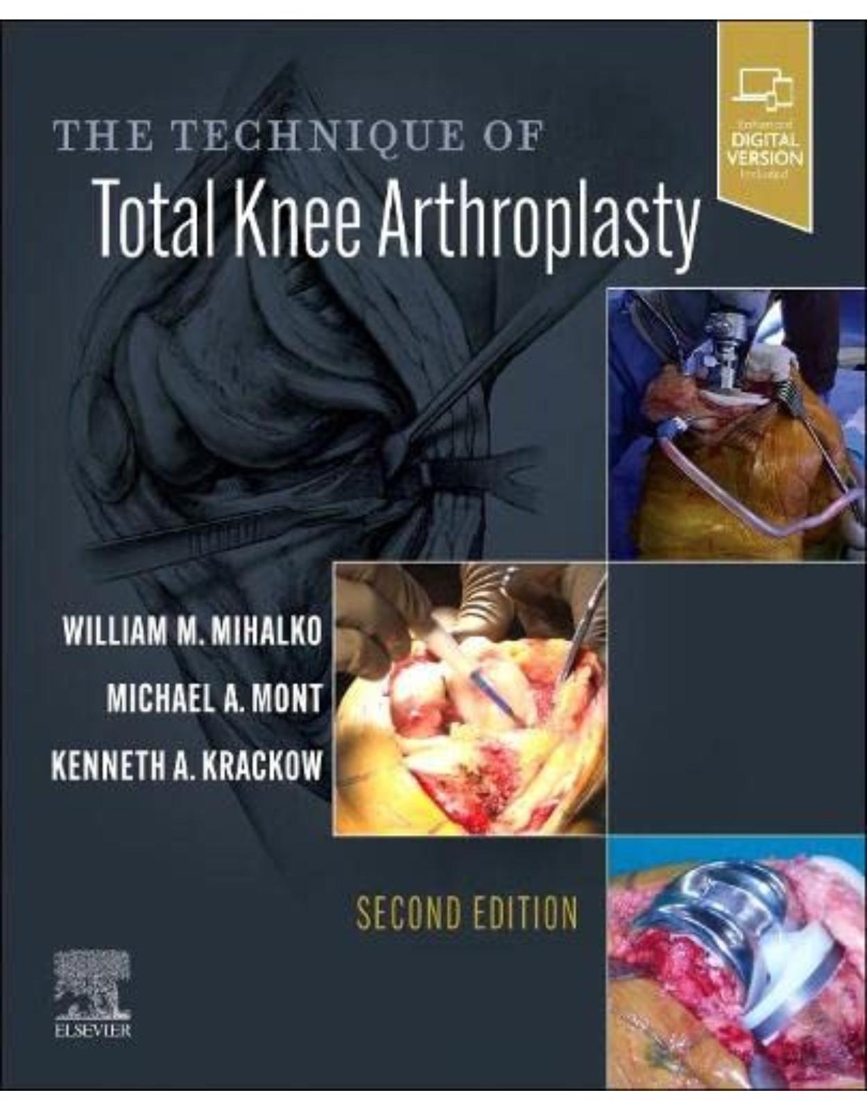 The Technique of Total Knee Arthroplasty