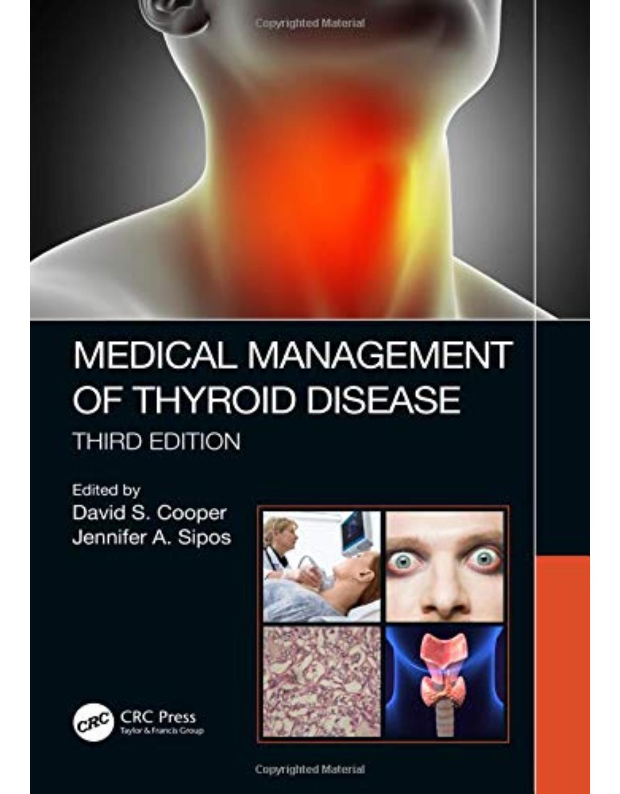 Medical Management of Thyroid Disease, Third Edition