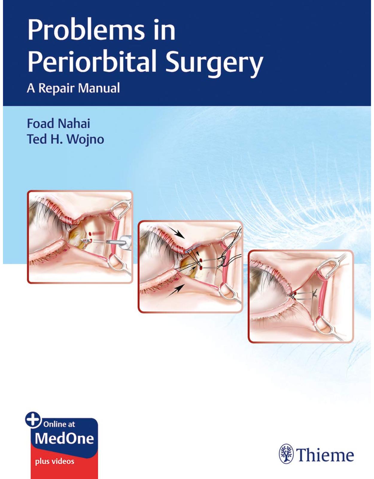 Problems in Periorbital Surgery: A Repair Manual