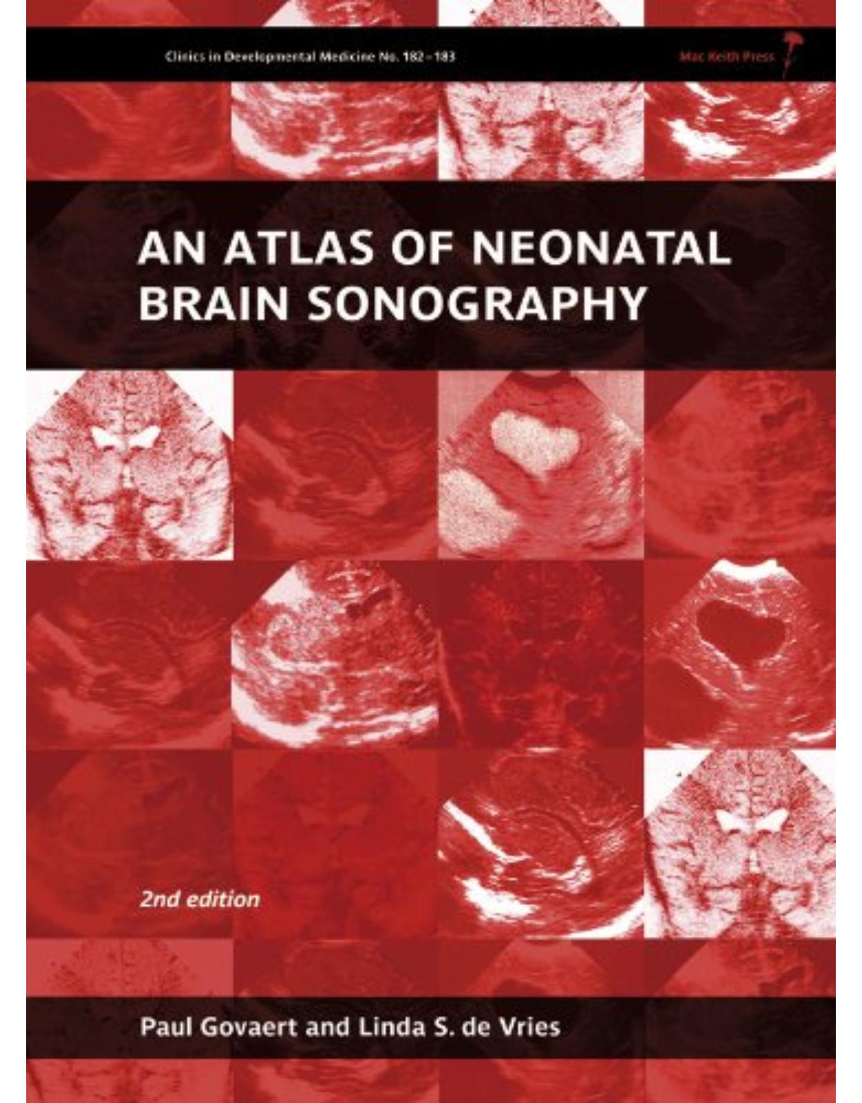 An Atlas of Neonatal Brain Sonography