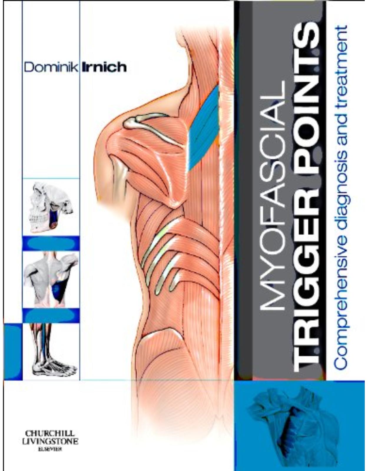 Myofascial Trigger Points: Comprehensive diagnosis and treatment, 1e