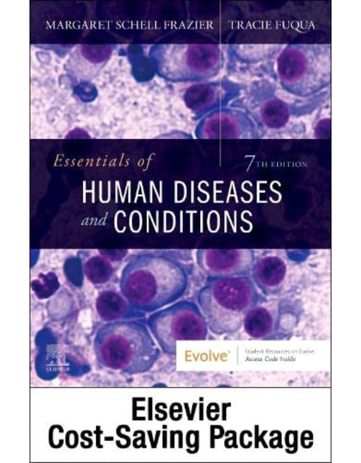 Essentials of Human Diseases and Conditions