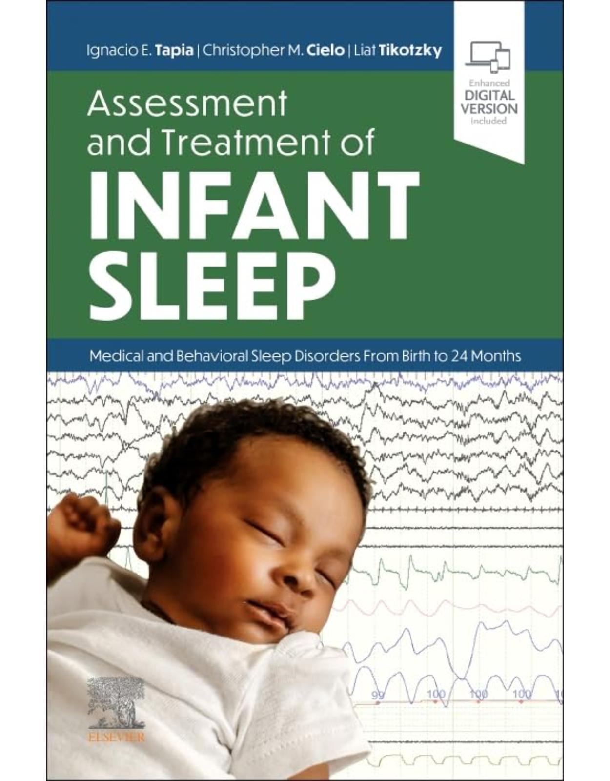Assessment and Treatment of Infant Sleep