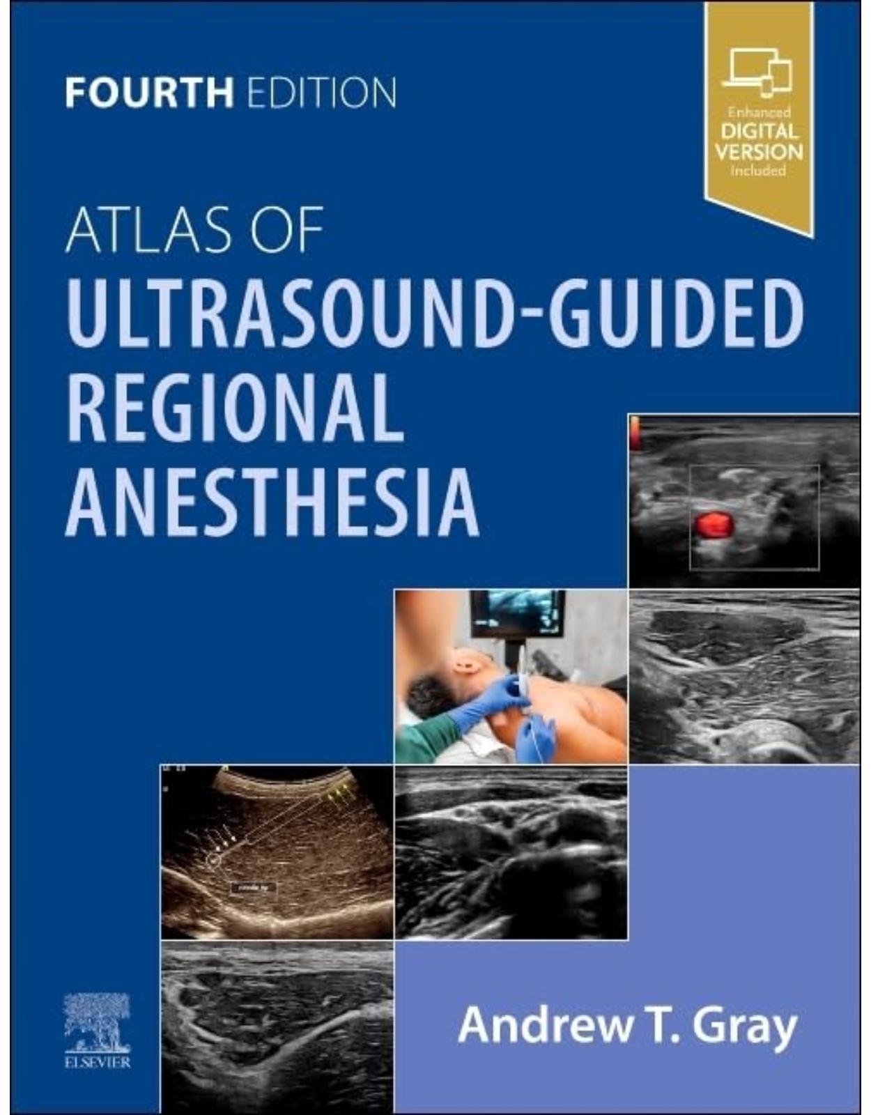 Atlas of Ultrasound-Guided Regional Anesthesia, 4th Edition 