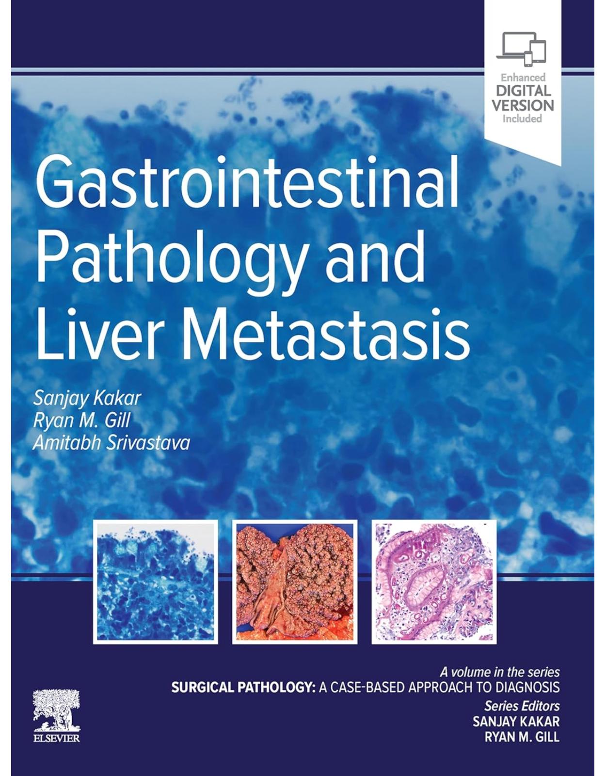 Gastrointestinal Pathology and Liver Metastasis: A Case-Based Approach to Diagnosis, 1st Edition 