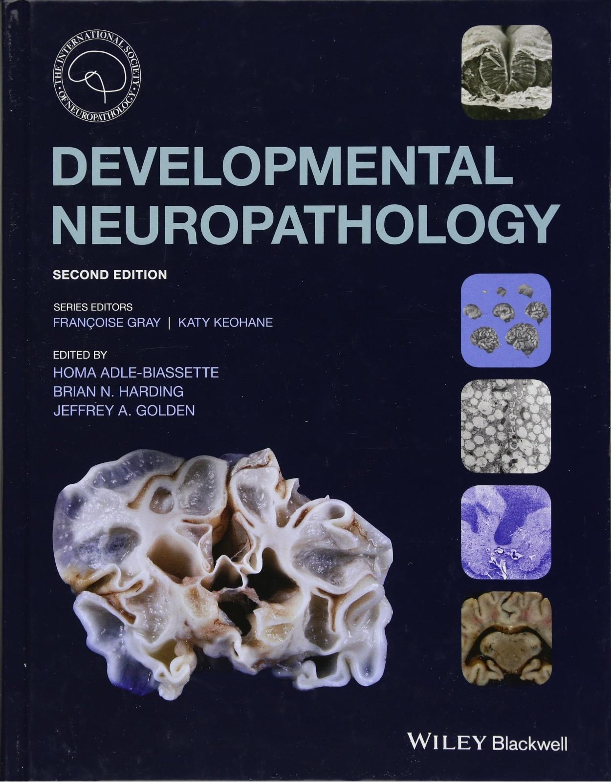 Developmental Neuropathology