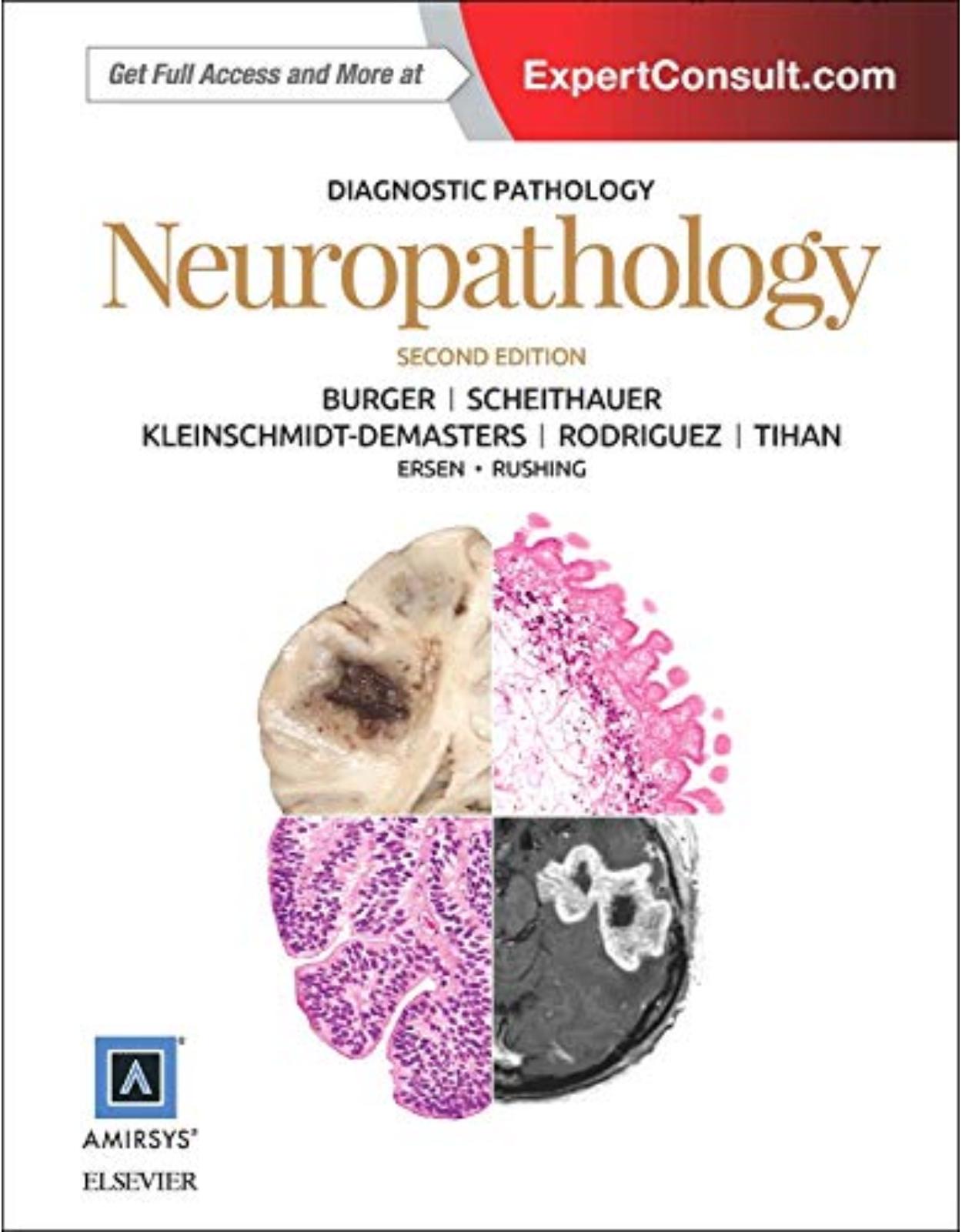 Diagnostic Pathology: Neuropathology, 2e