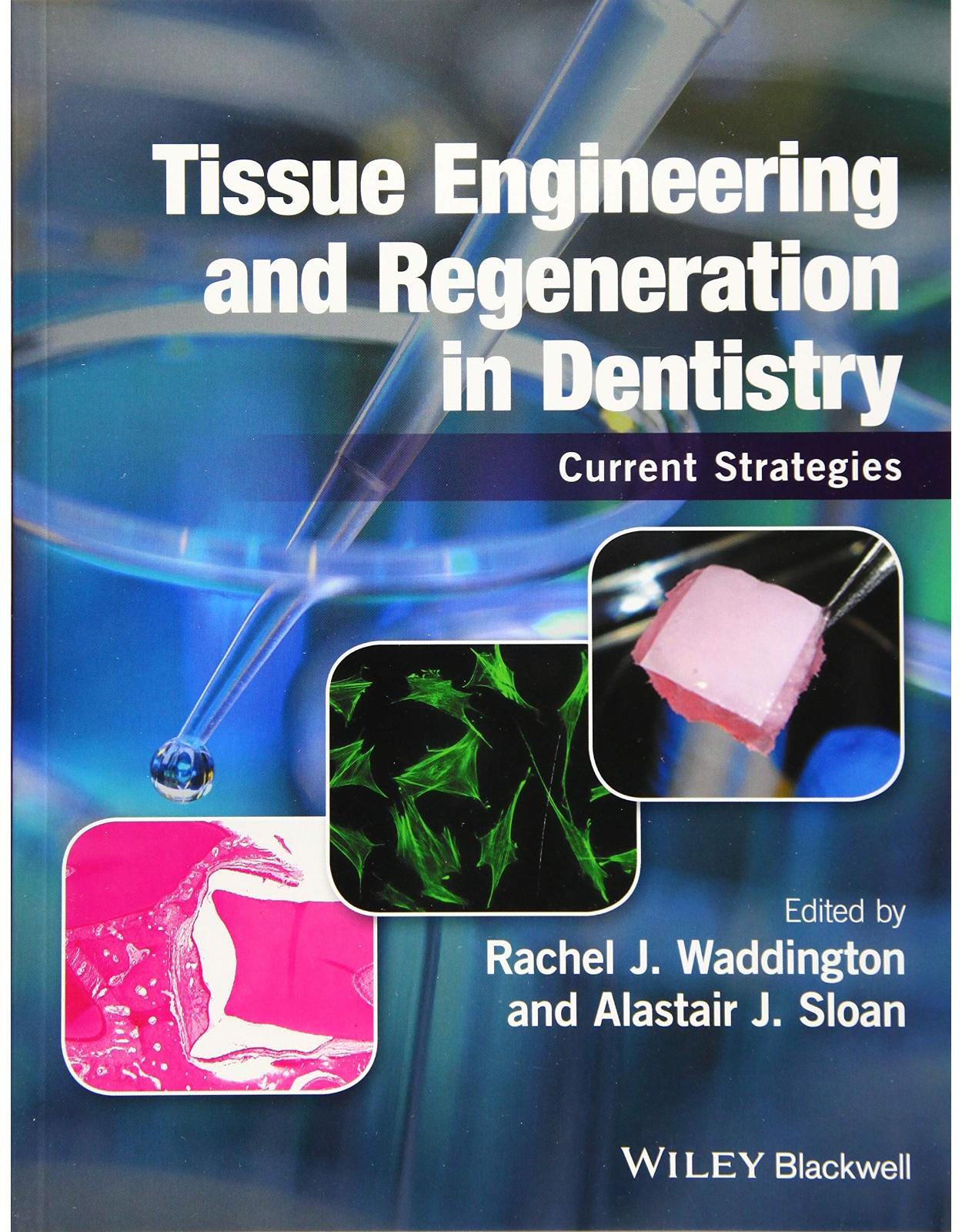 Tissue Engineering and Regeneration in Dentistry: Current Strategies