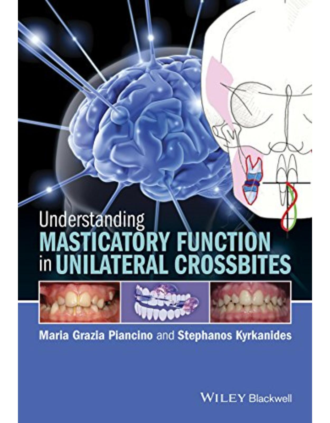 Understanding Masticatory Function in Unilateral Crossbites