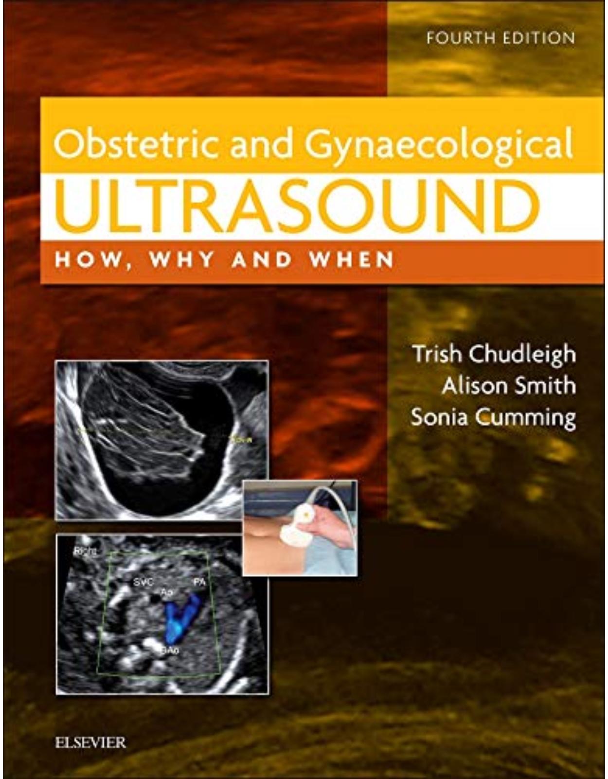 Obstetric & Gynaecological Ultrasound: How, Why and When, 4e