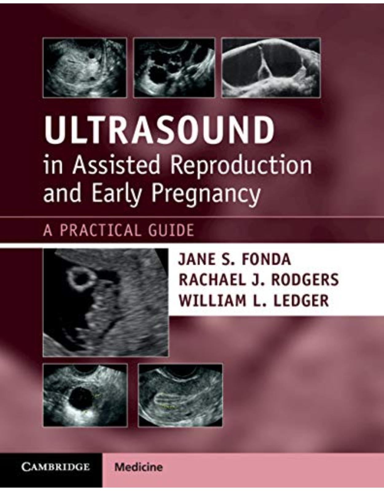 Ultrasound in Assisted Reproduction and Early Pregnancy: A Practical Guide